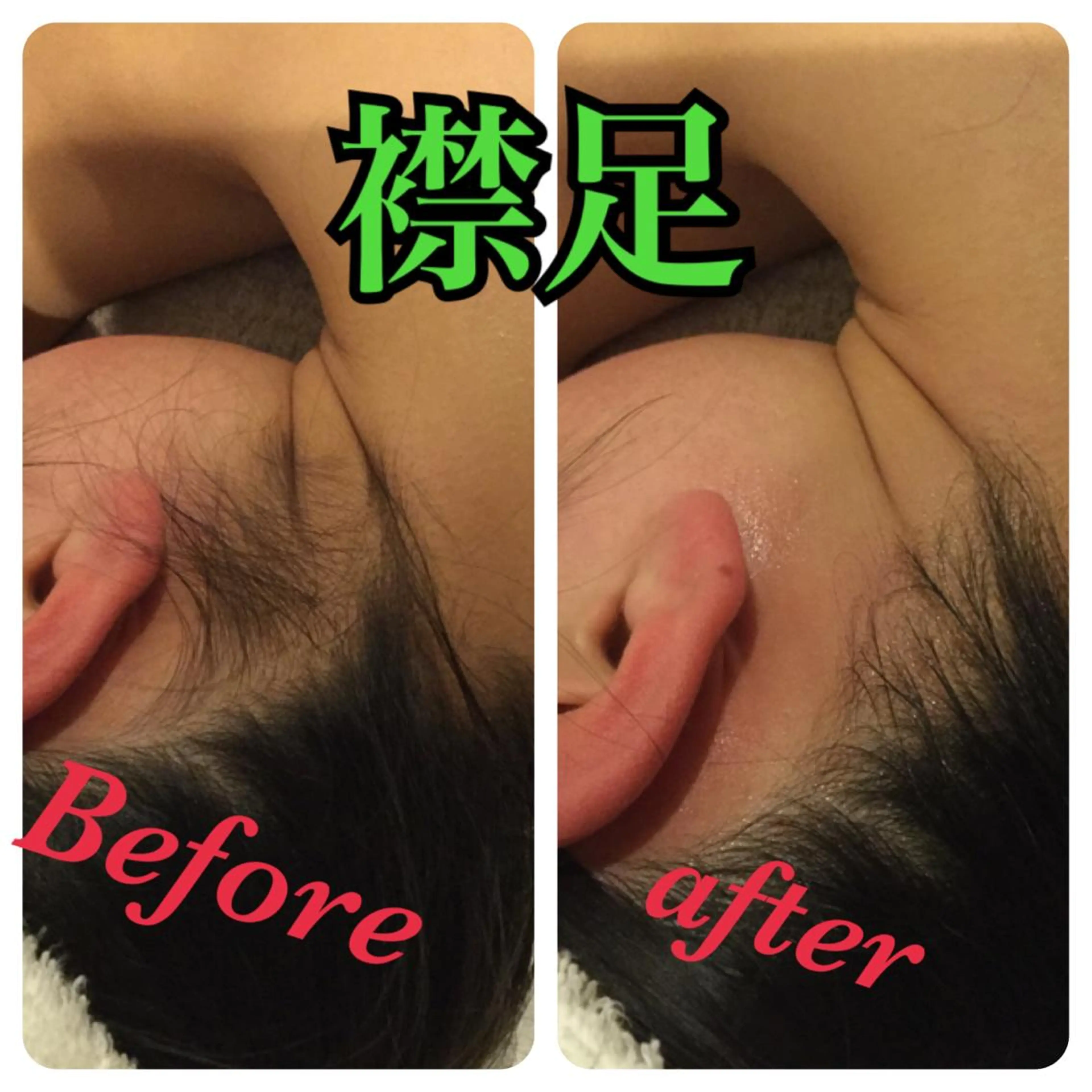 【リベルハーブピーリング認定店】敏感肌・美白脱毛専門店Dione立川店所属・Dione 立川店のエステ・リラクイメージ