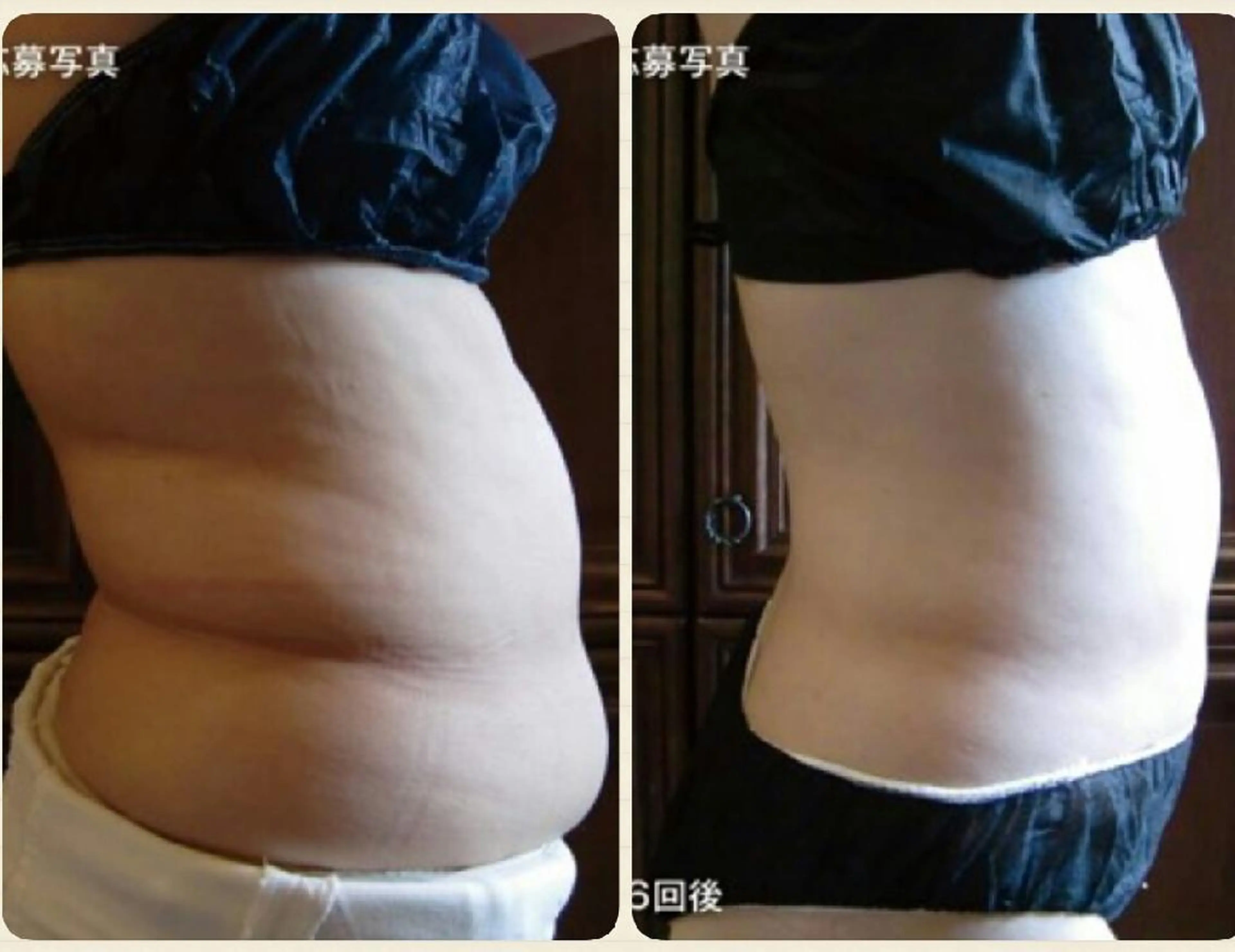 ﾌﾟﾗｲﾍﾞｰﾄｻﾛﾝ アンクチュール所属・UnCouture 〜アンクチュール〜のエステ・リラクイメージ