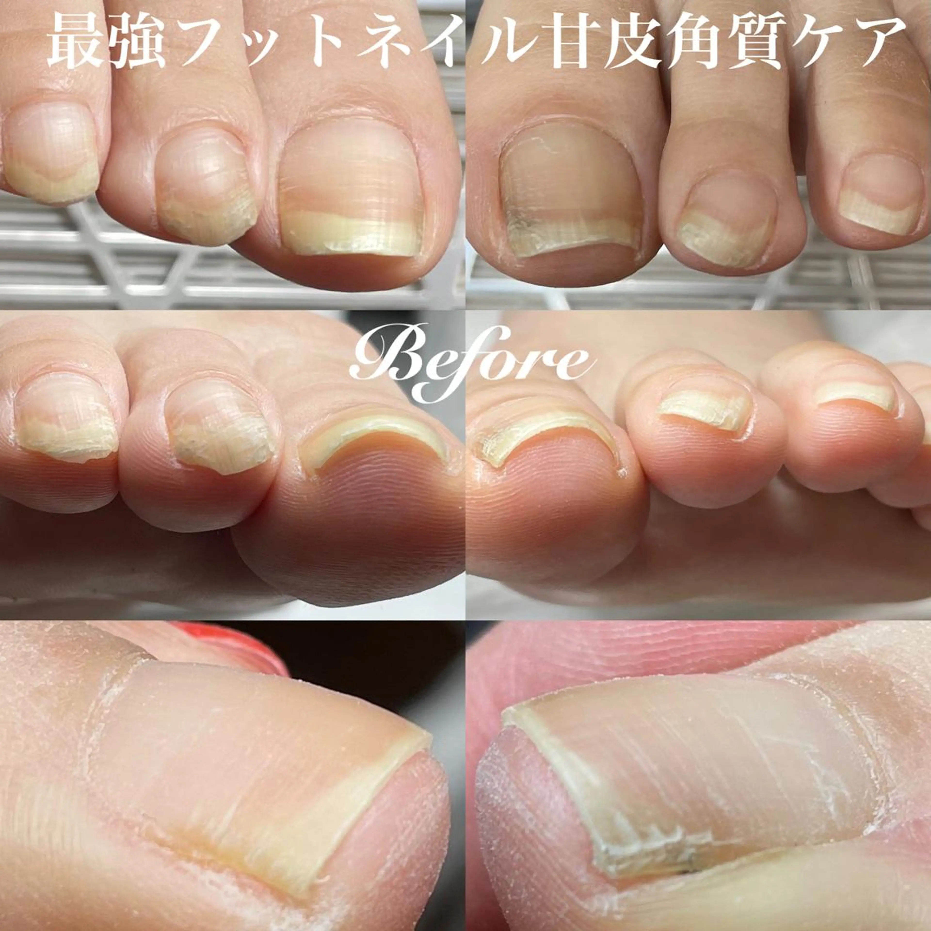 ネイル フットネイル フットネイル .Nails Mio 赤羽西ネイルサロンのネイルデザイン