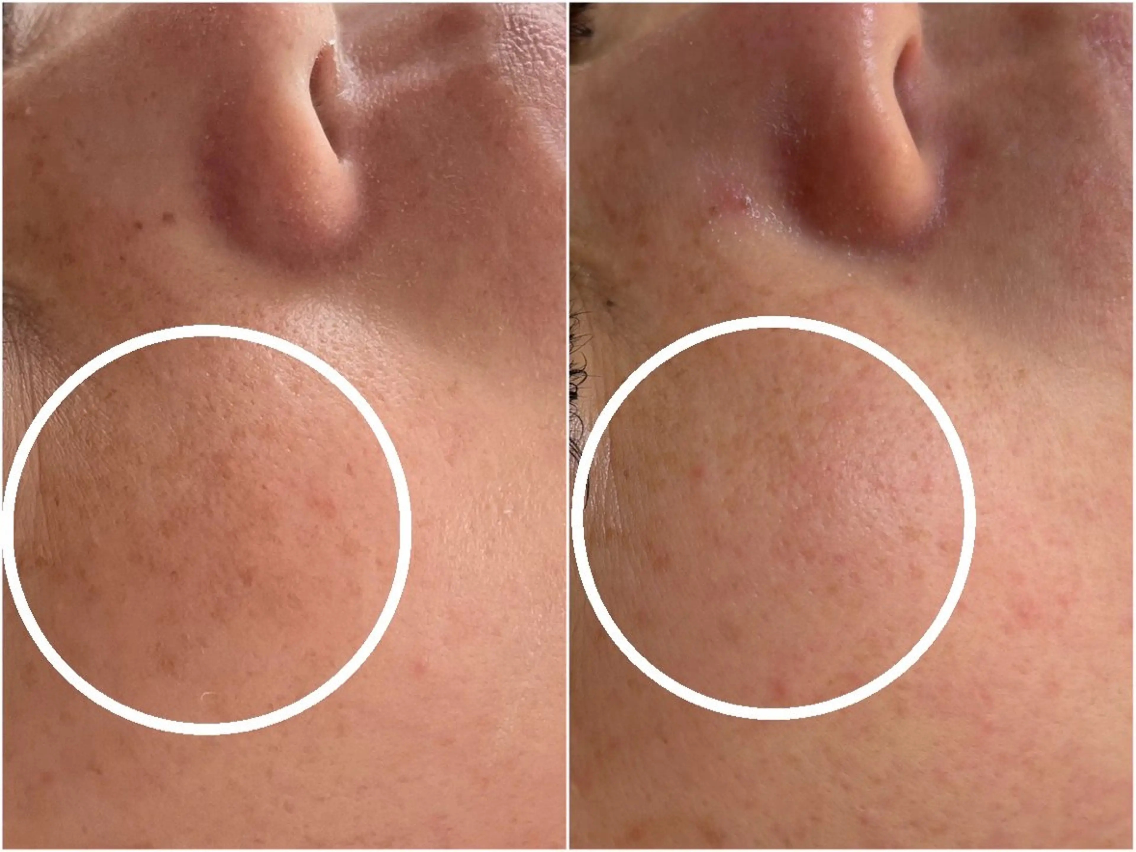 肌質改善|天王寺 For...はるかのエステ・リラクイメージ