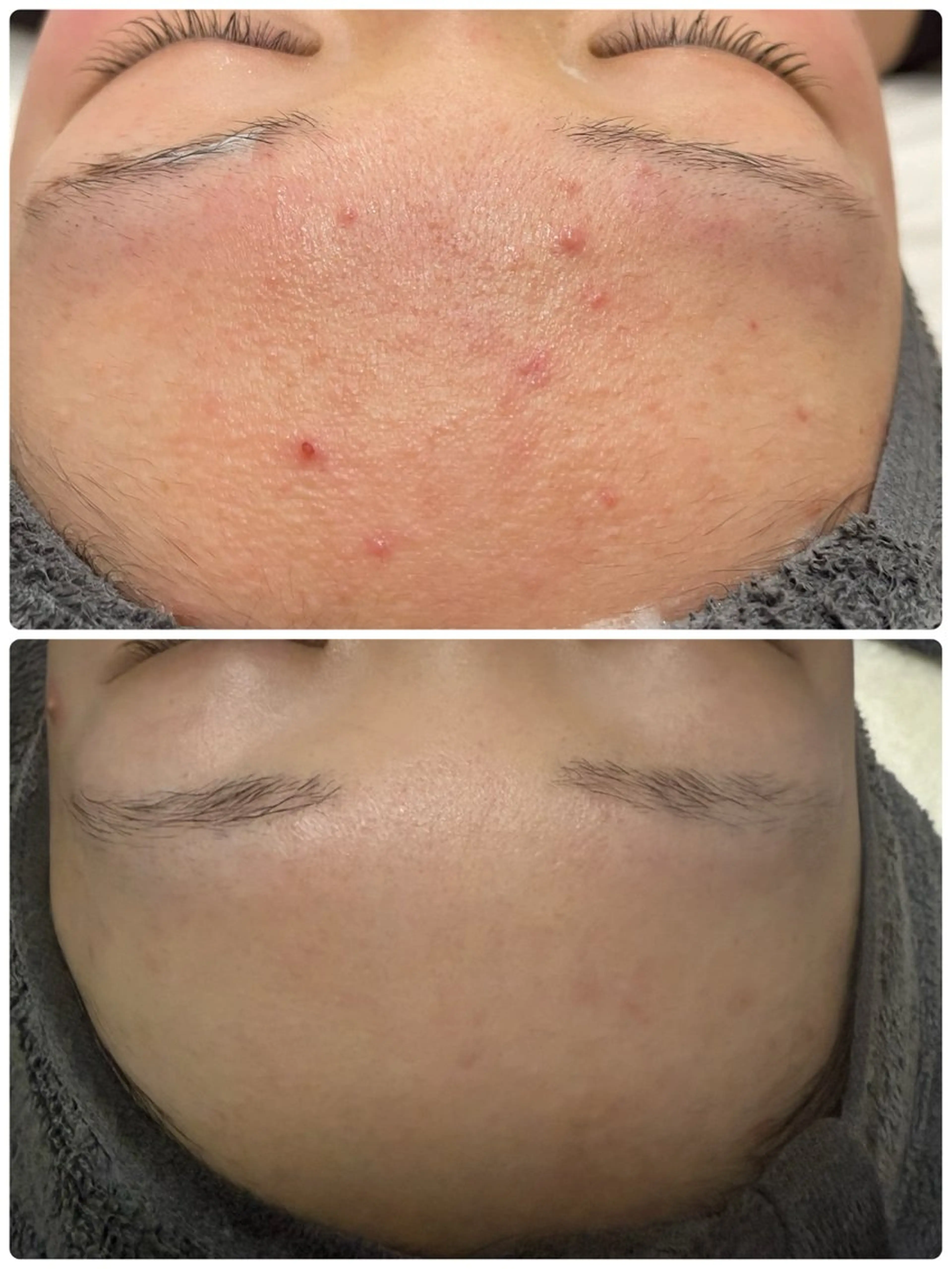 エステ NHerb【エヌハーブ】所属・横田 汐里のネイルデザイン