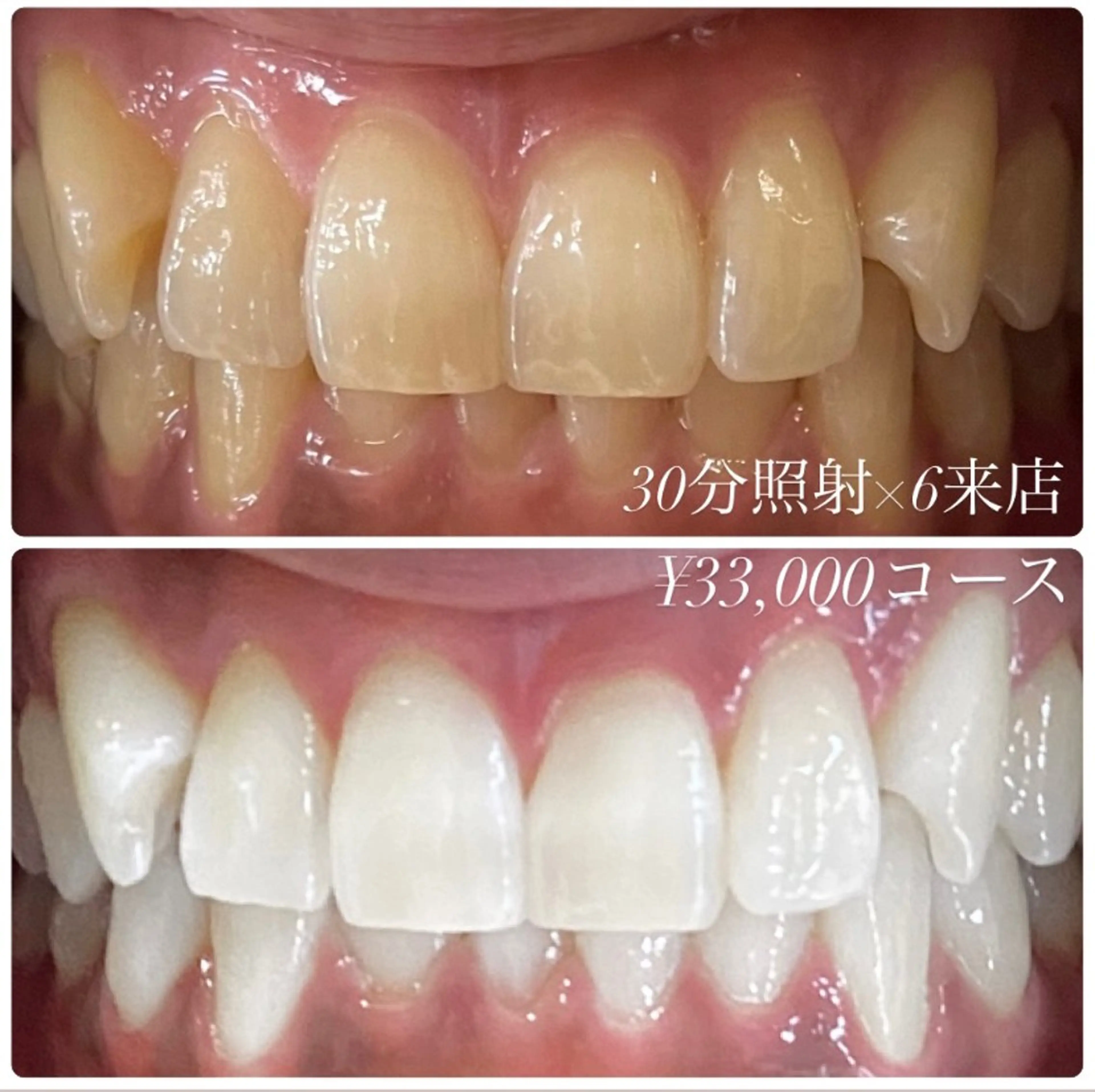 メンズ キッズ その他 ホワイトニングルーム　川崎店所属・ホワイトニング ルーム　川崎店のその他イメージ