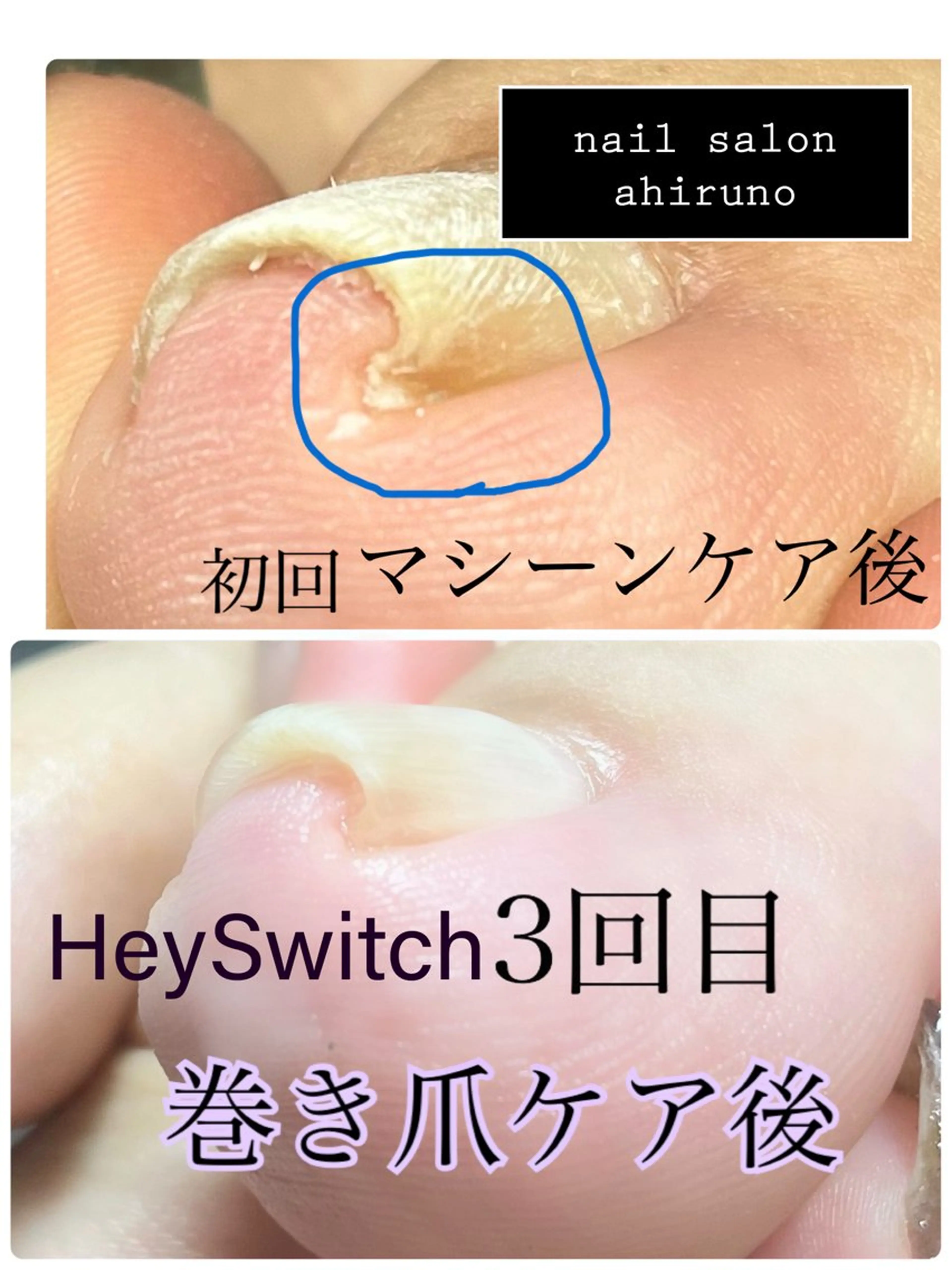 ネイル ジェルネイル 韓国ネイル フットネイル ａｈｉｒｕｎｏ ✿ ｙｕiのネイルデザイン