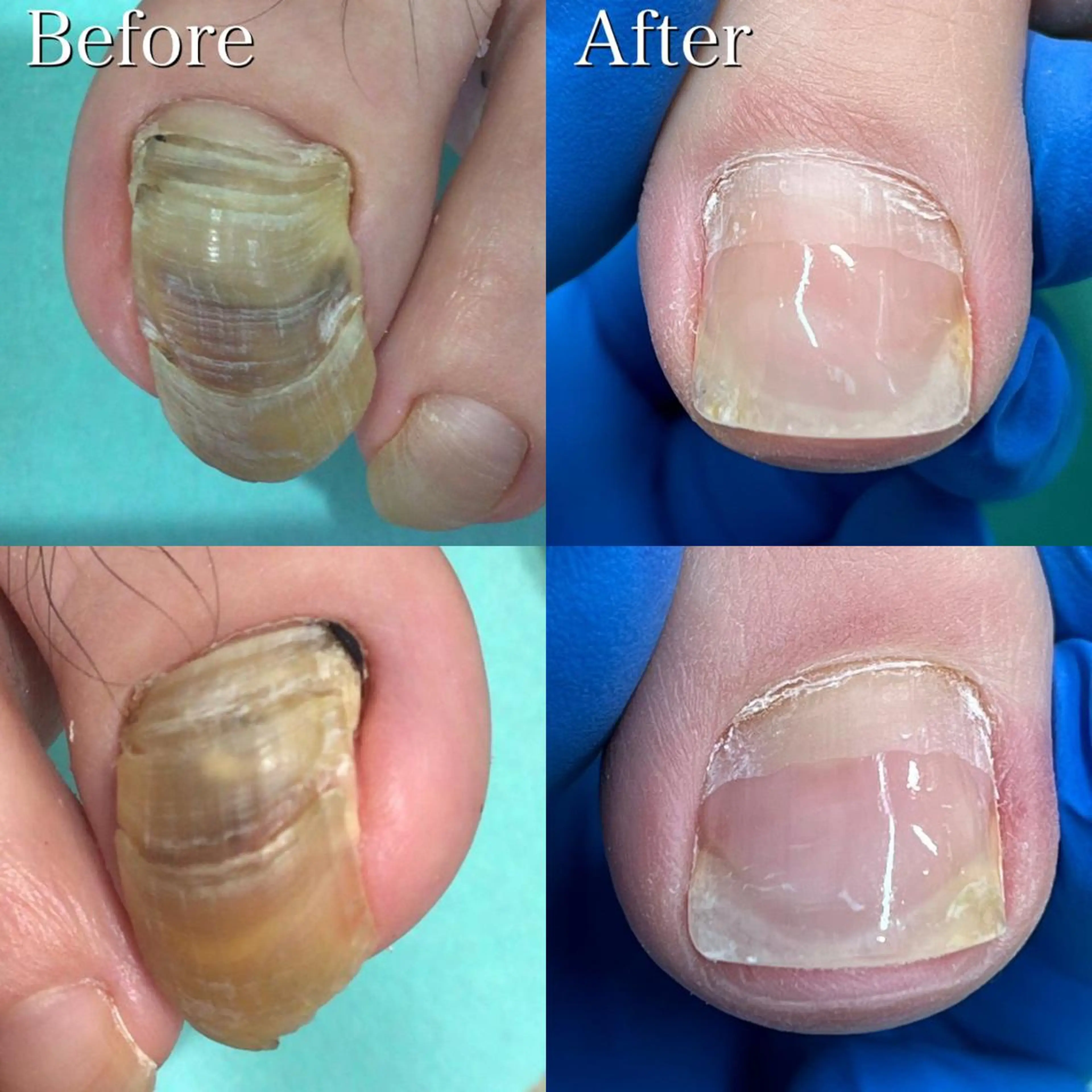 ネイル リラク サンキューフット浦和店所属・サンキューフット 浦和店のエステ・リラクイメージ