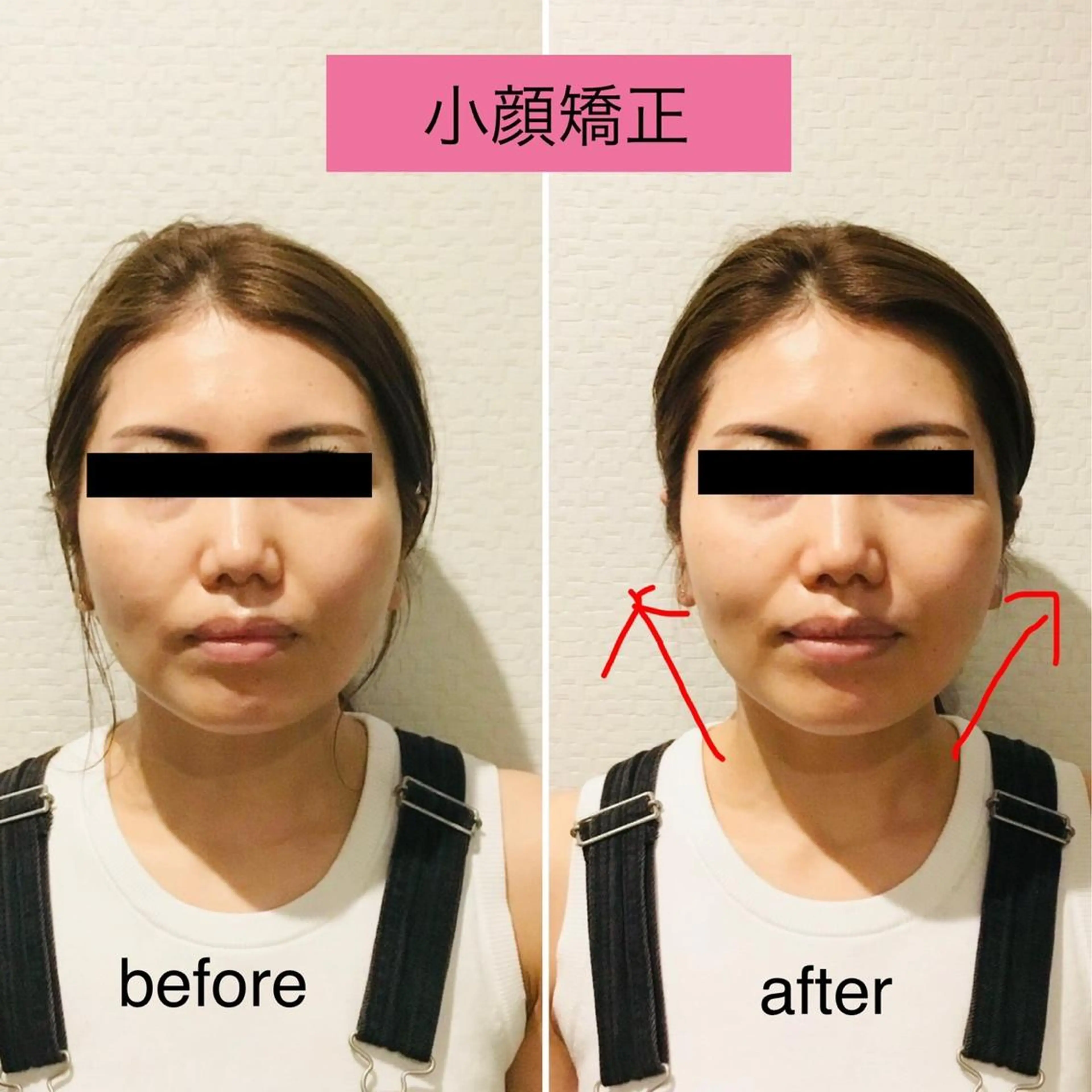 チキバン美容鍼灸整体 サロン心斎橋店のエステ・リラクイメージ