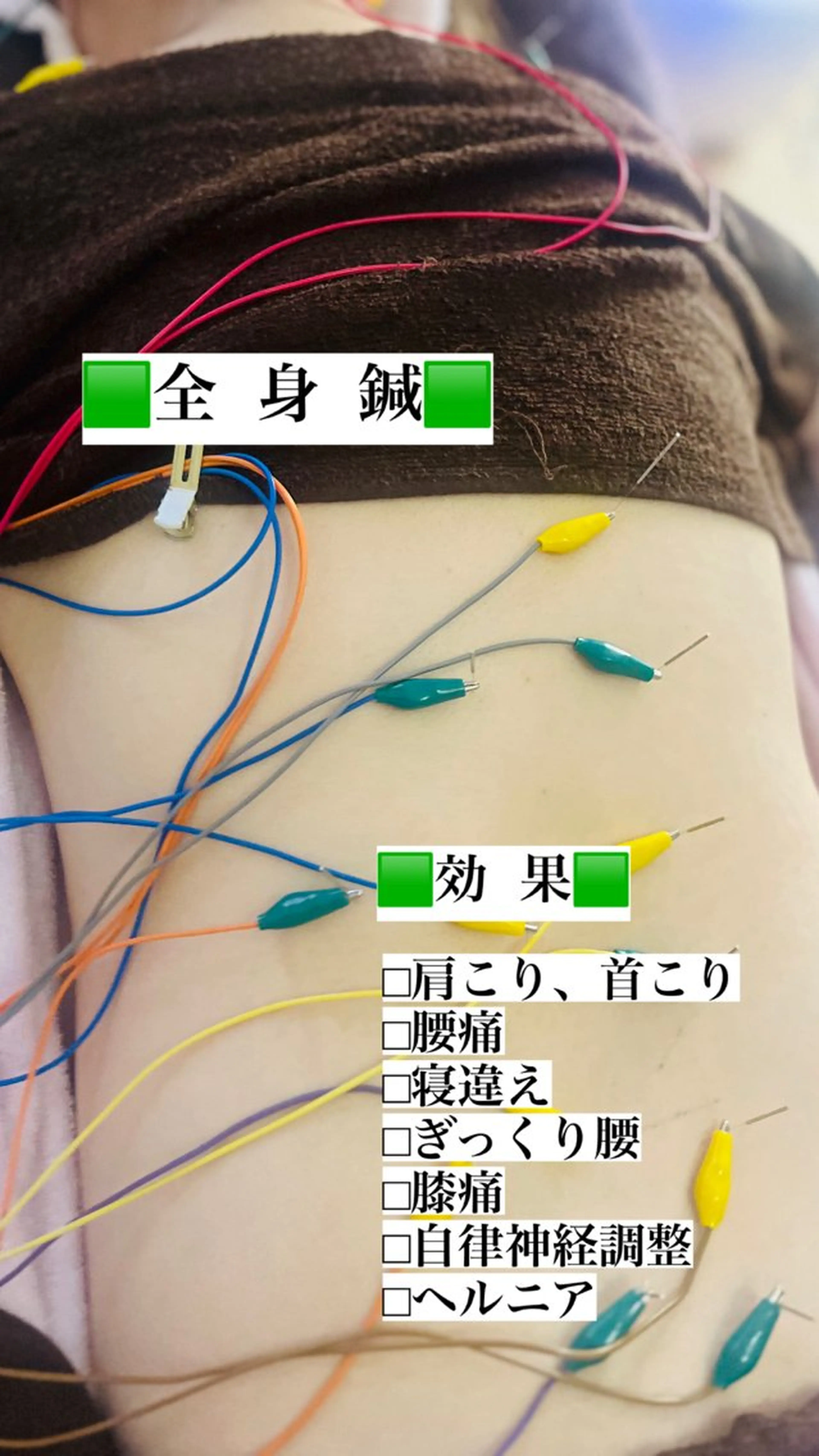 リラク アロマ･美容鍼･カッ ピング「麗」鍼灸院のエステ・リラクイメージ