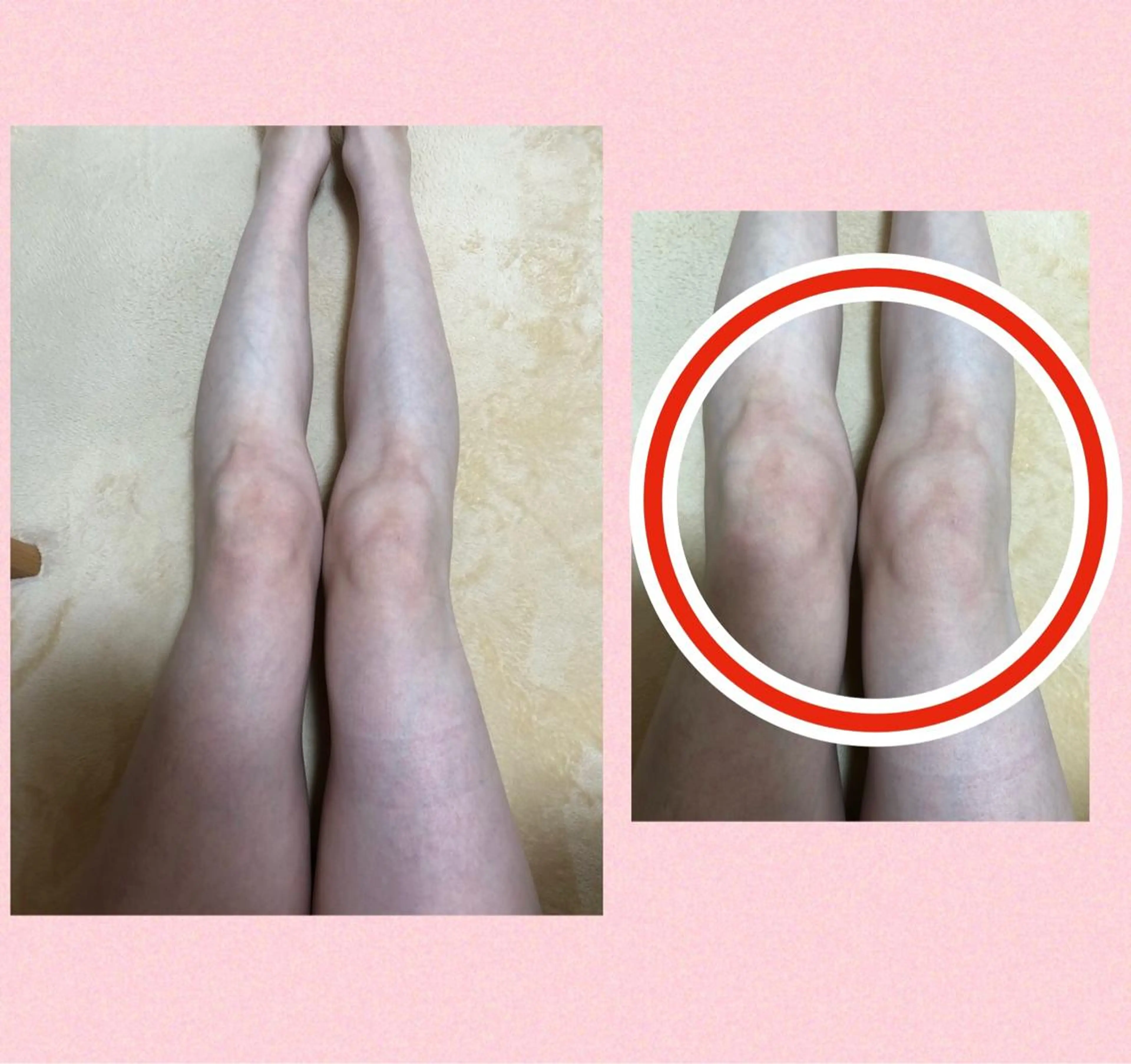 プライベートサロン CHOUETTEのエステ・リラクイメージ