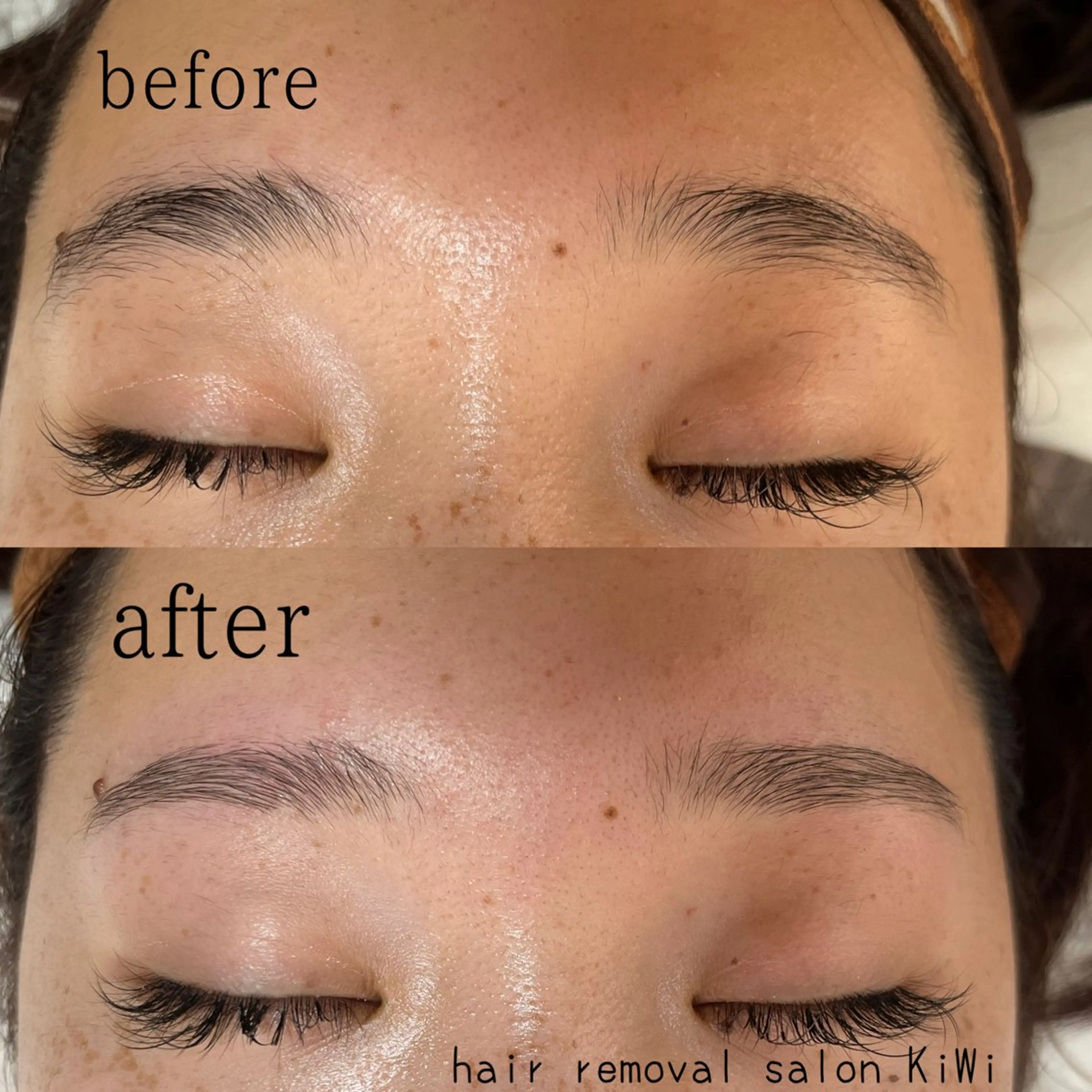 アイブロウ 眉毛ワックス脱毛 脱毛サロン KiWiのエステ・リラクイメージ