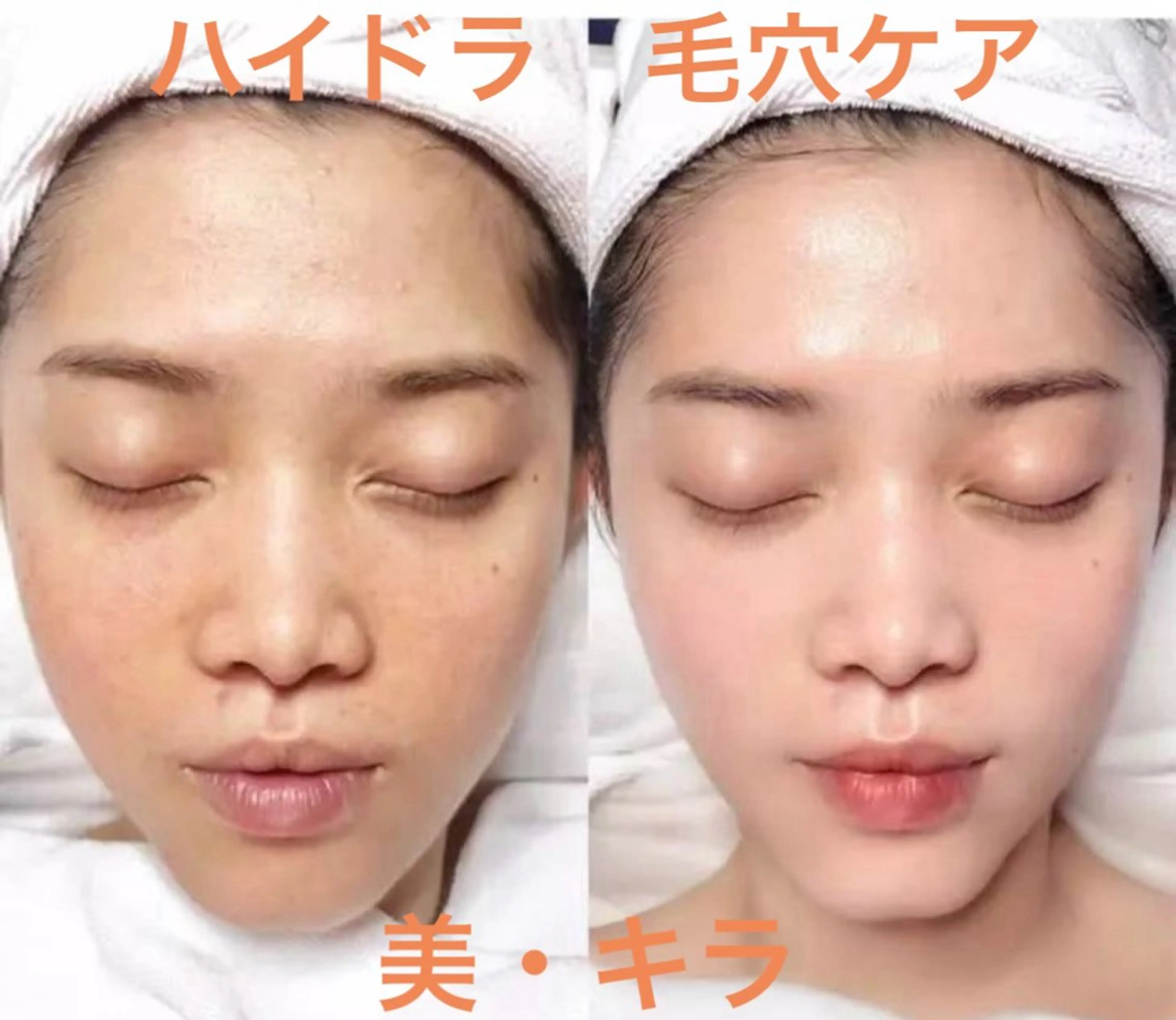 美・キラ ハイフ痩身&美肌のエステ・リラクイメージ