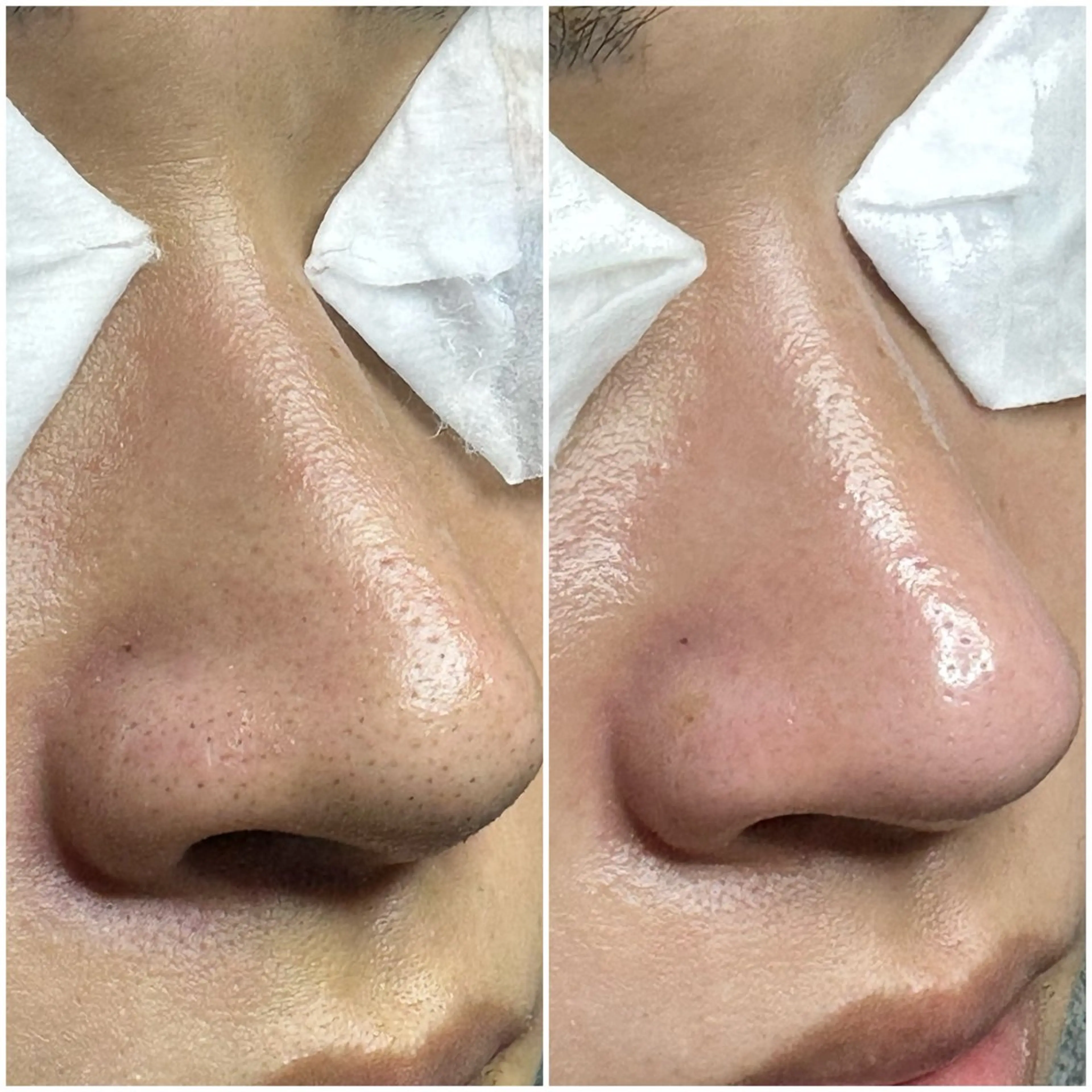 kanunu♡mana所属・豊橋/毛穴特化エステ 深層デトックスリンパのエステ・リラクイメージ