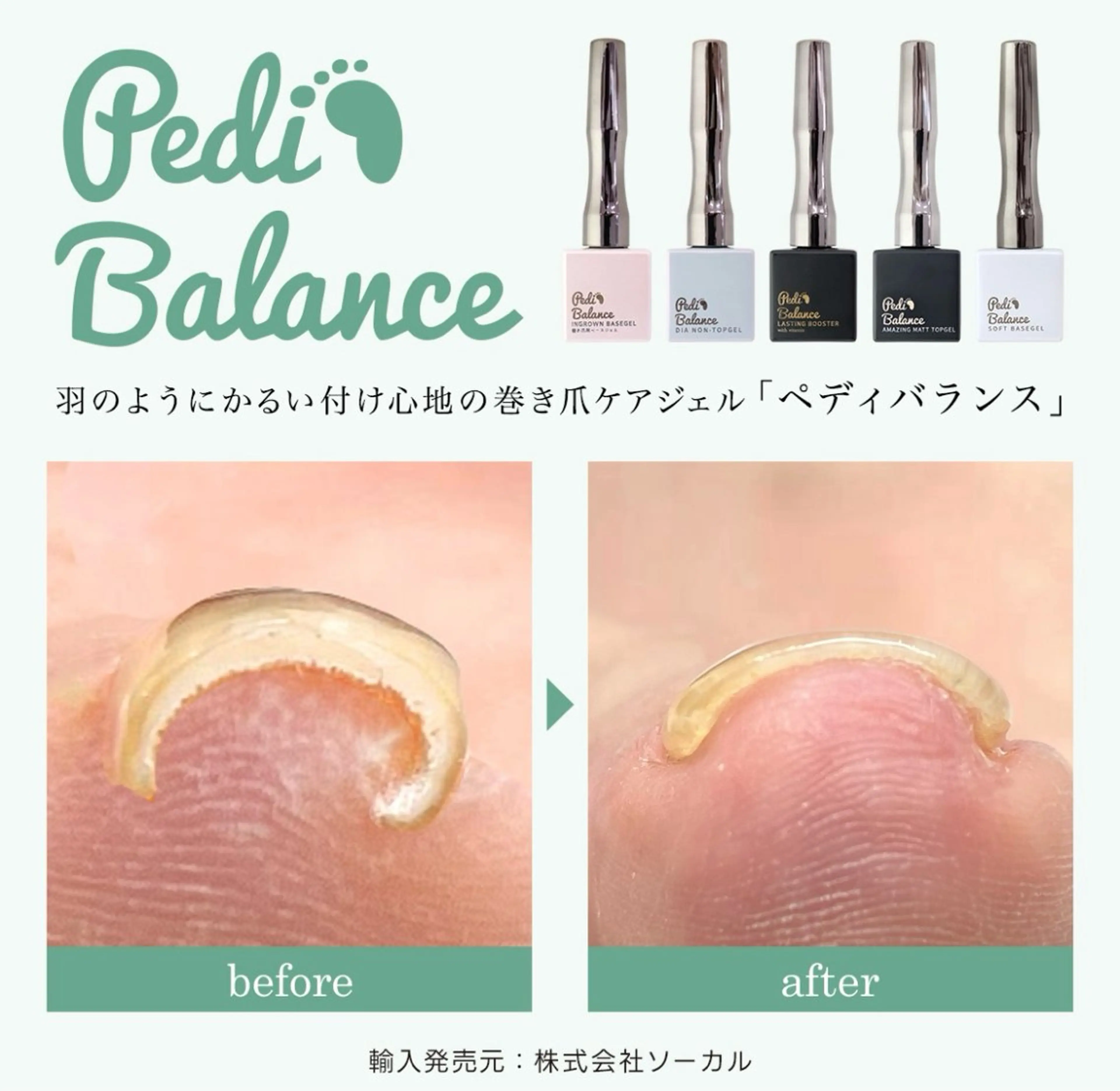 巻き爪ケア含めた1カラー👣【PediBalance】の写真