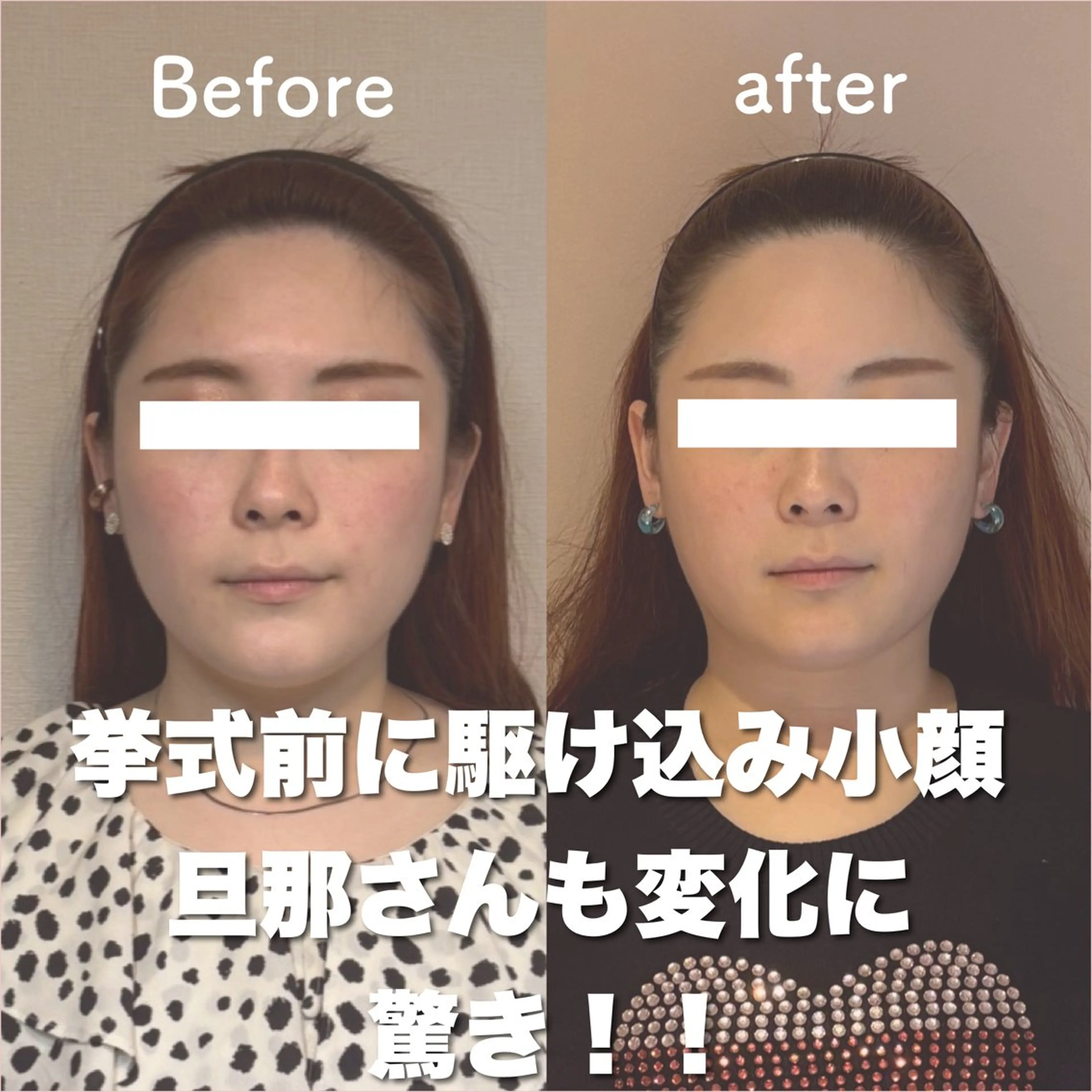 【小顔効果No.1】整形級小顔へ！！ヘッドスパ＋オーダーメイド小顔矯正＋巻き肩改善デコルテオイルマッサージの写真