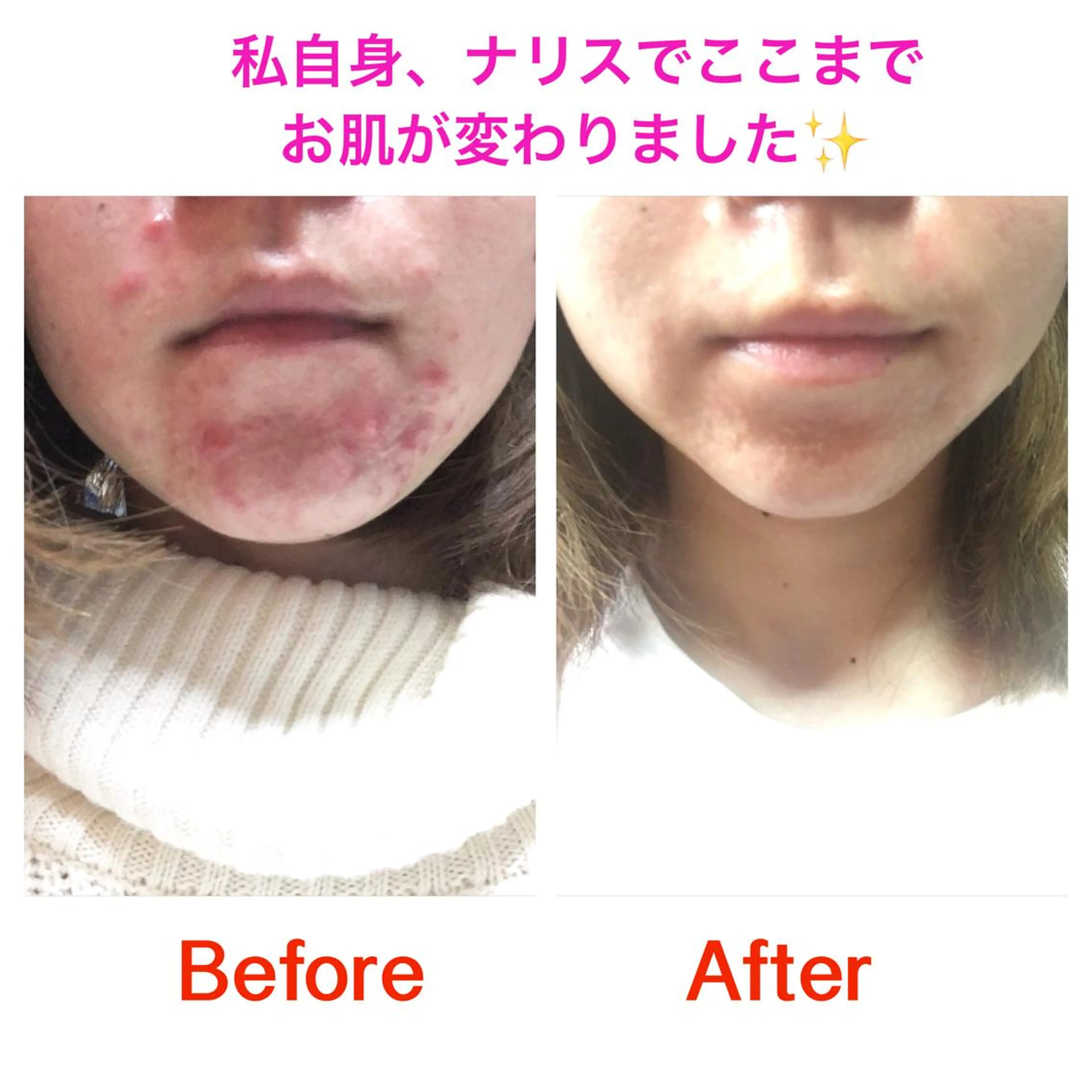 Bène Soin du Esthétique所属・逵中 元香のエステ・リラクイメージ