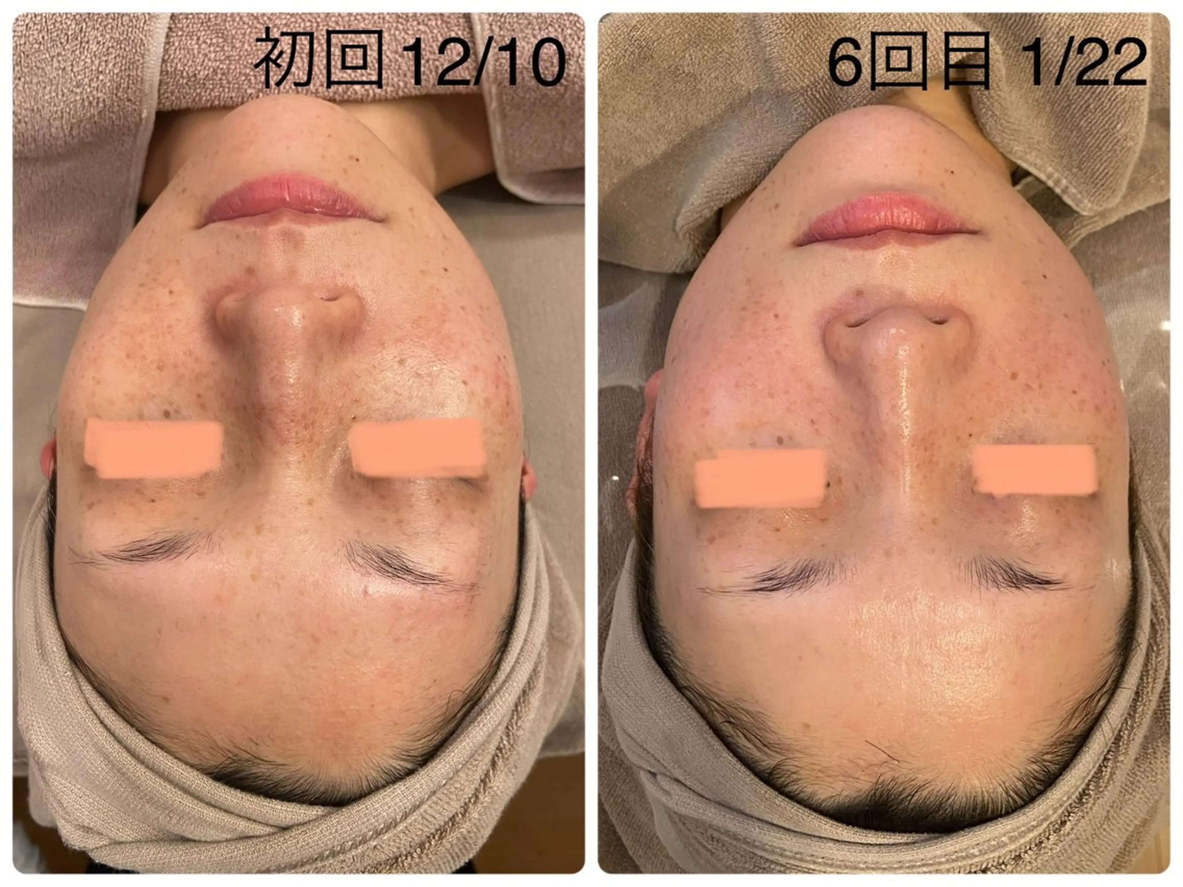 Hisui 小出のエステ・リラクイメージ