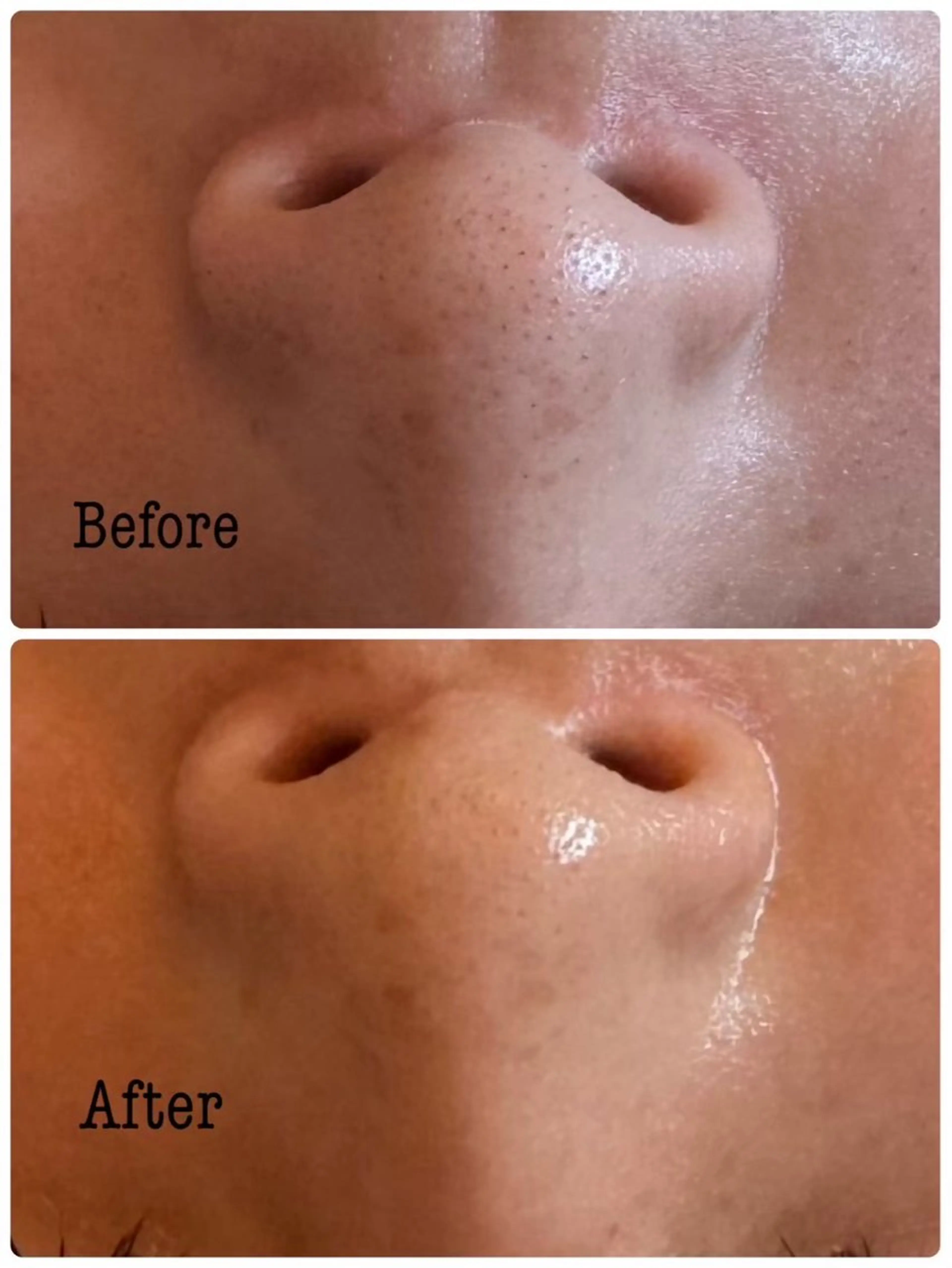 エステ グランジュテ所属・グランジュテ グランジュテのエステ・リラクイメージ