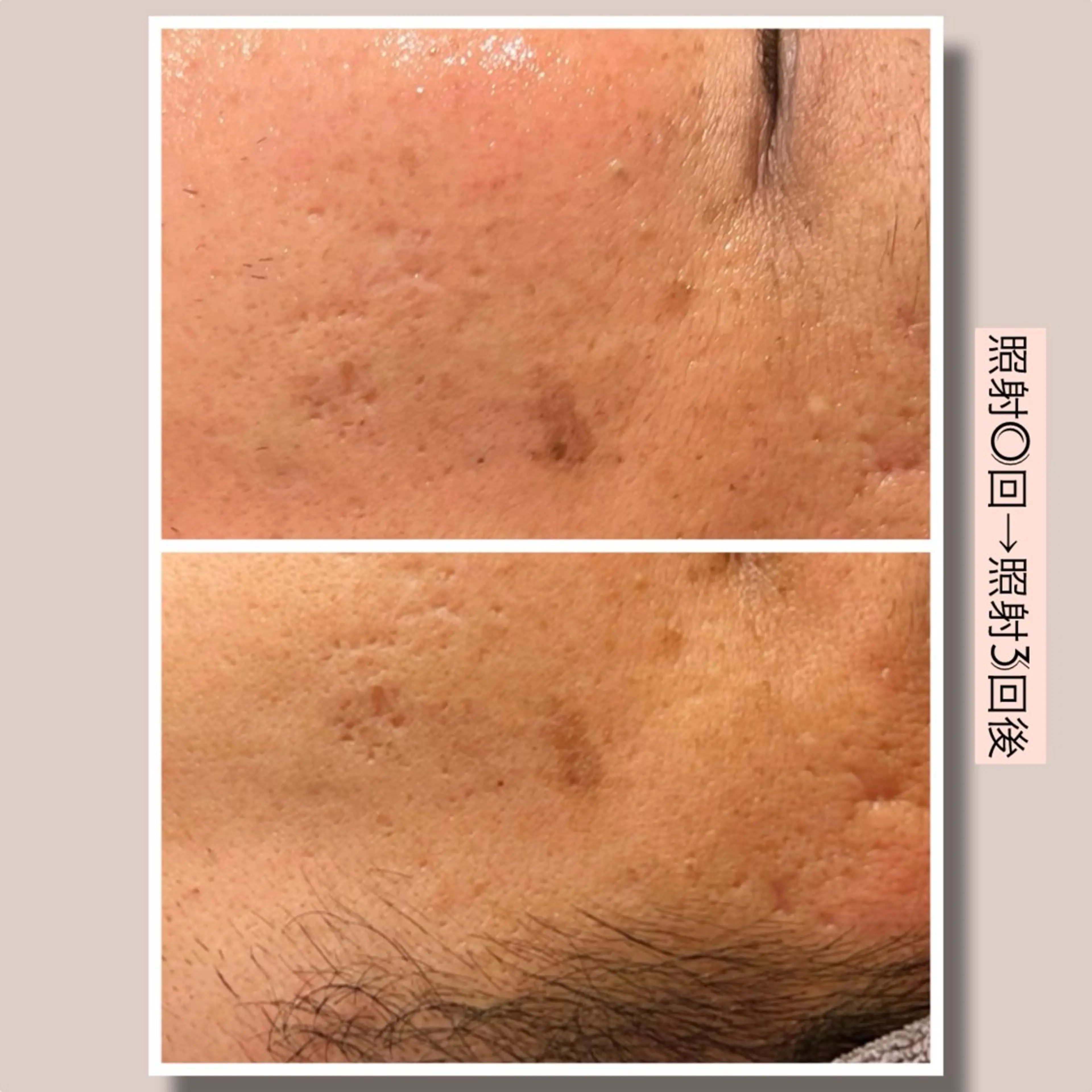 ☆痩身/小顔☆ コルギのエステ・リラクイメージ