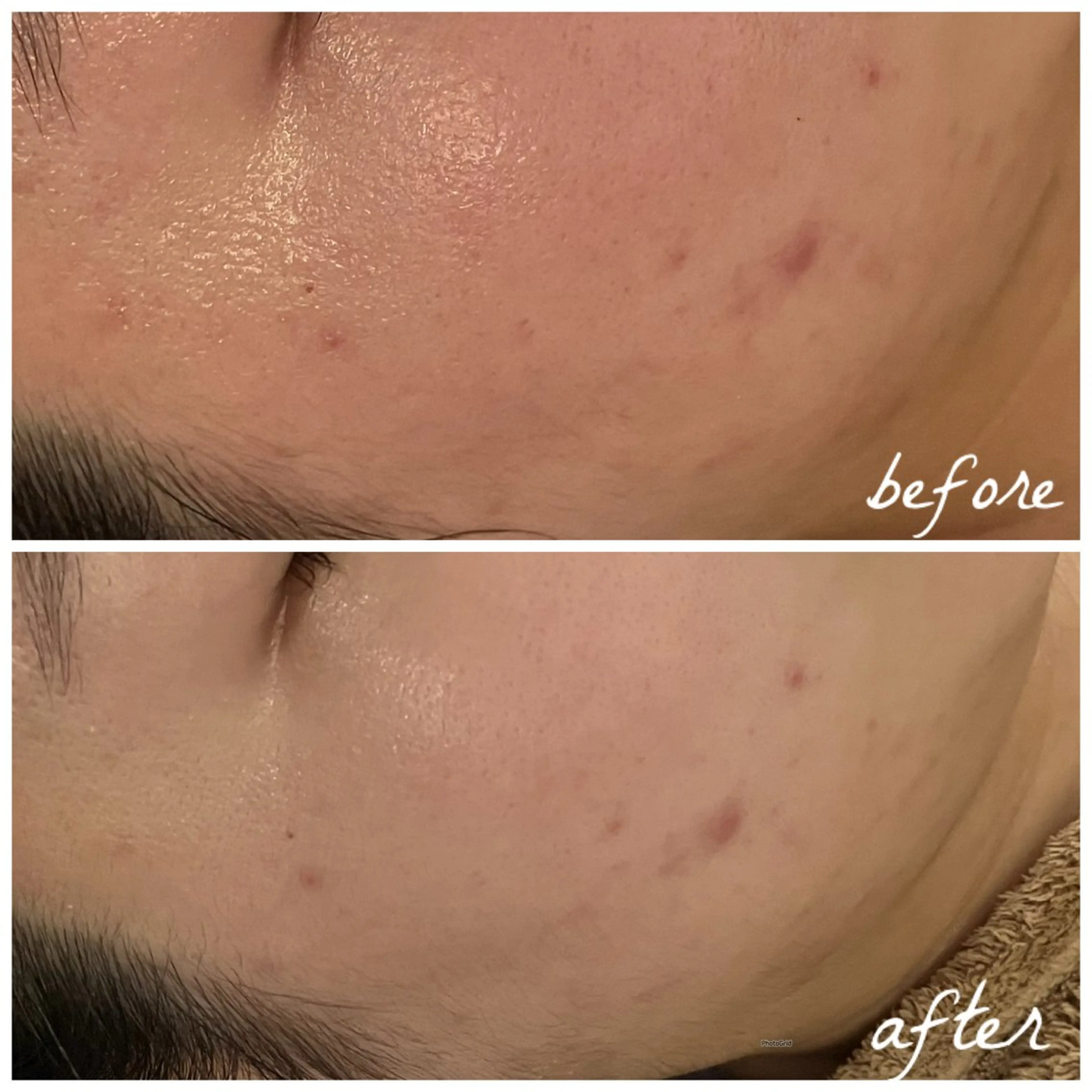 メンズ エステ メナード岐阜茜部 杉浦のエステ・リラクイメージ