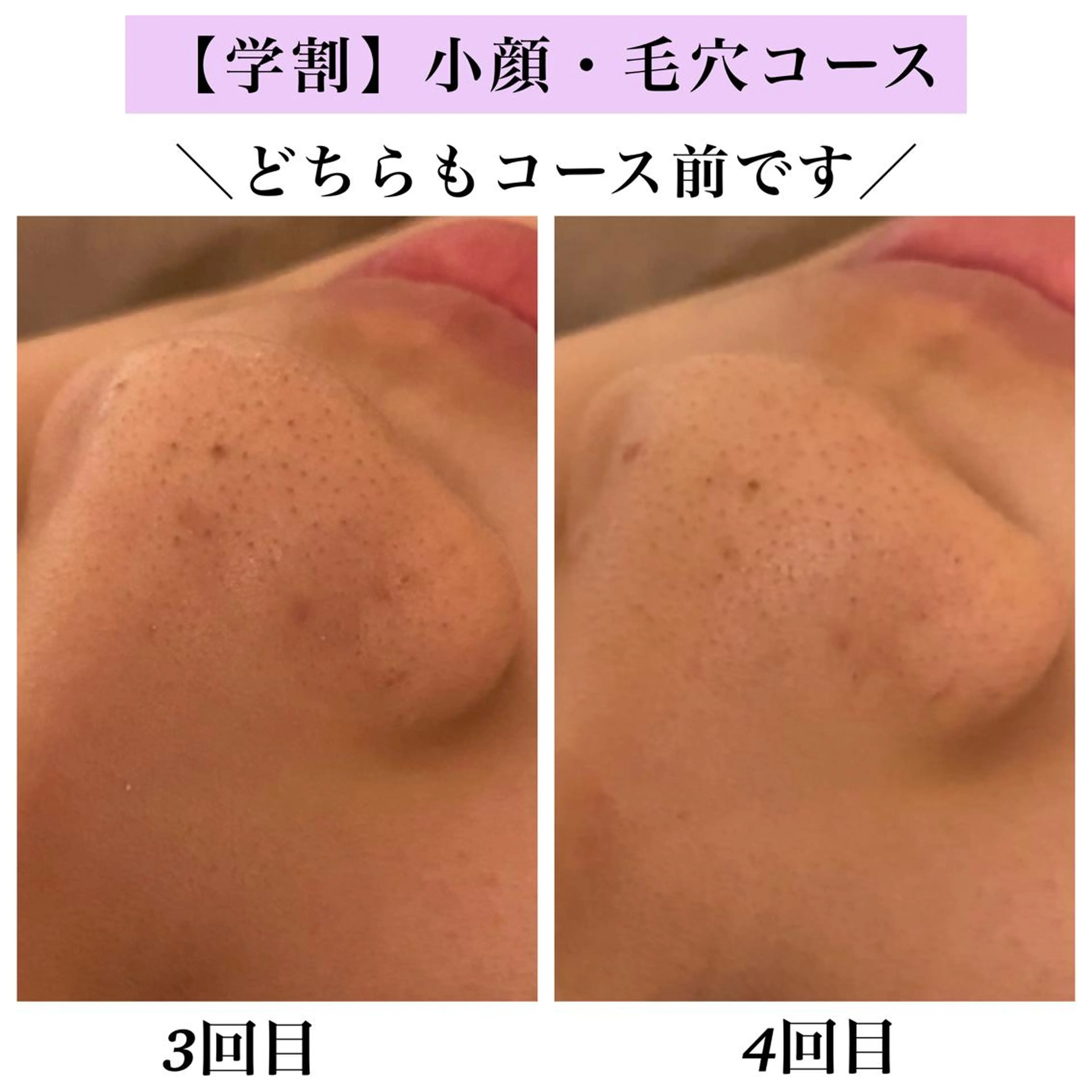 Bellesthe (ベルエステ)のエステ・リラクイメージ