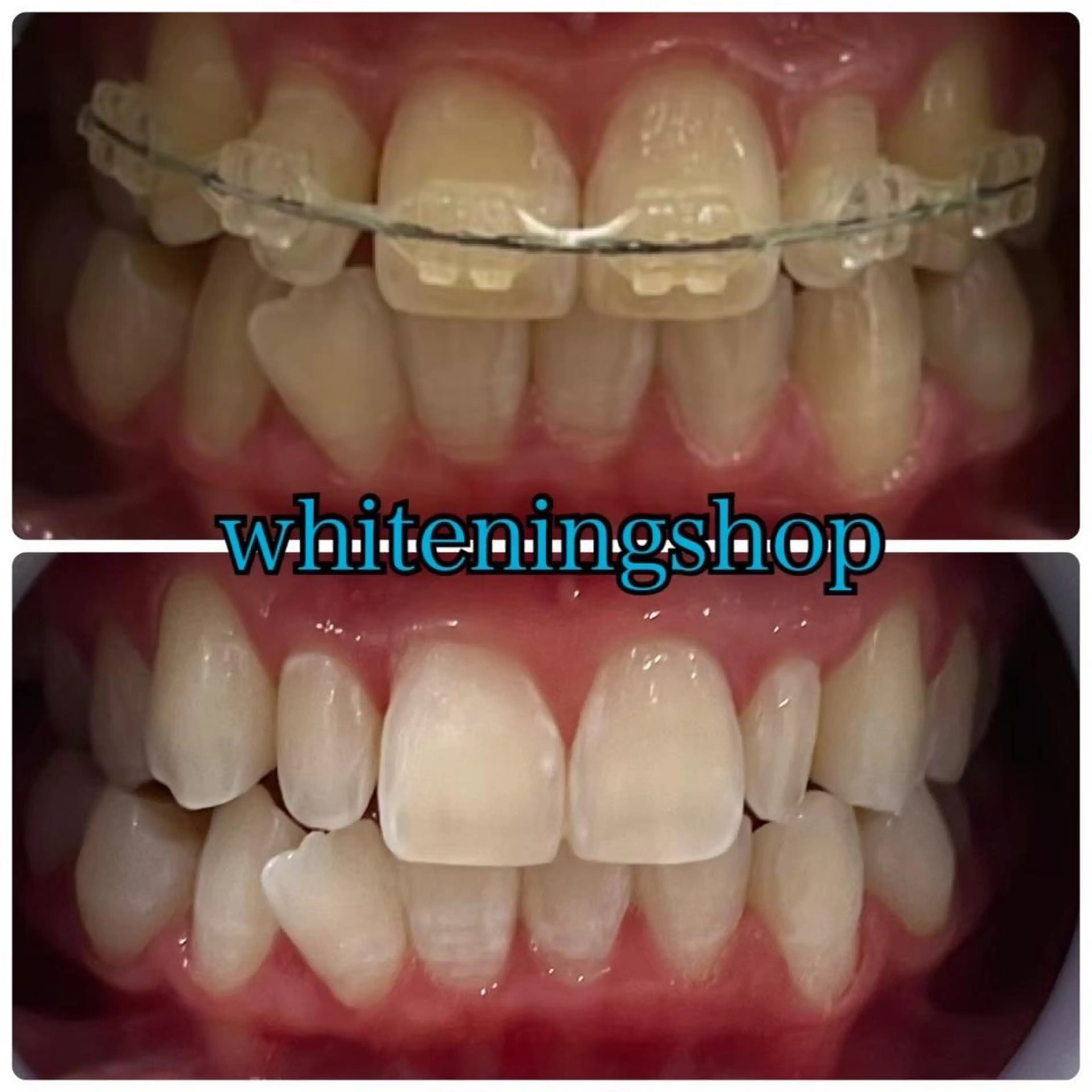 ホワイトニング ショップ千葉店のその他イメージ