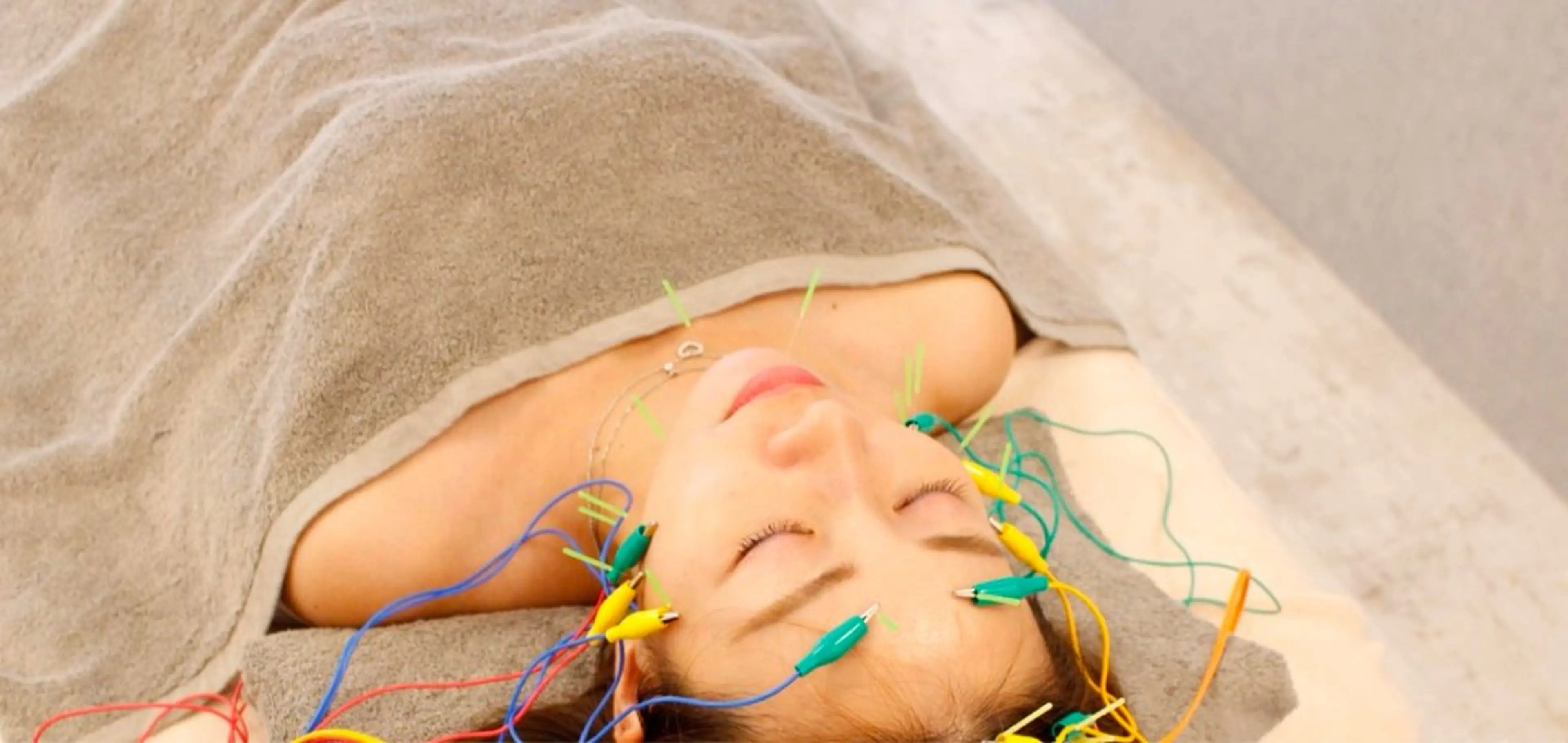 人気No.3【電気美容鍼】(首肩背中マッサージ&頭皮スパ)劇的小顔!引き上がり、むくみ解消🎄の写真