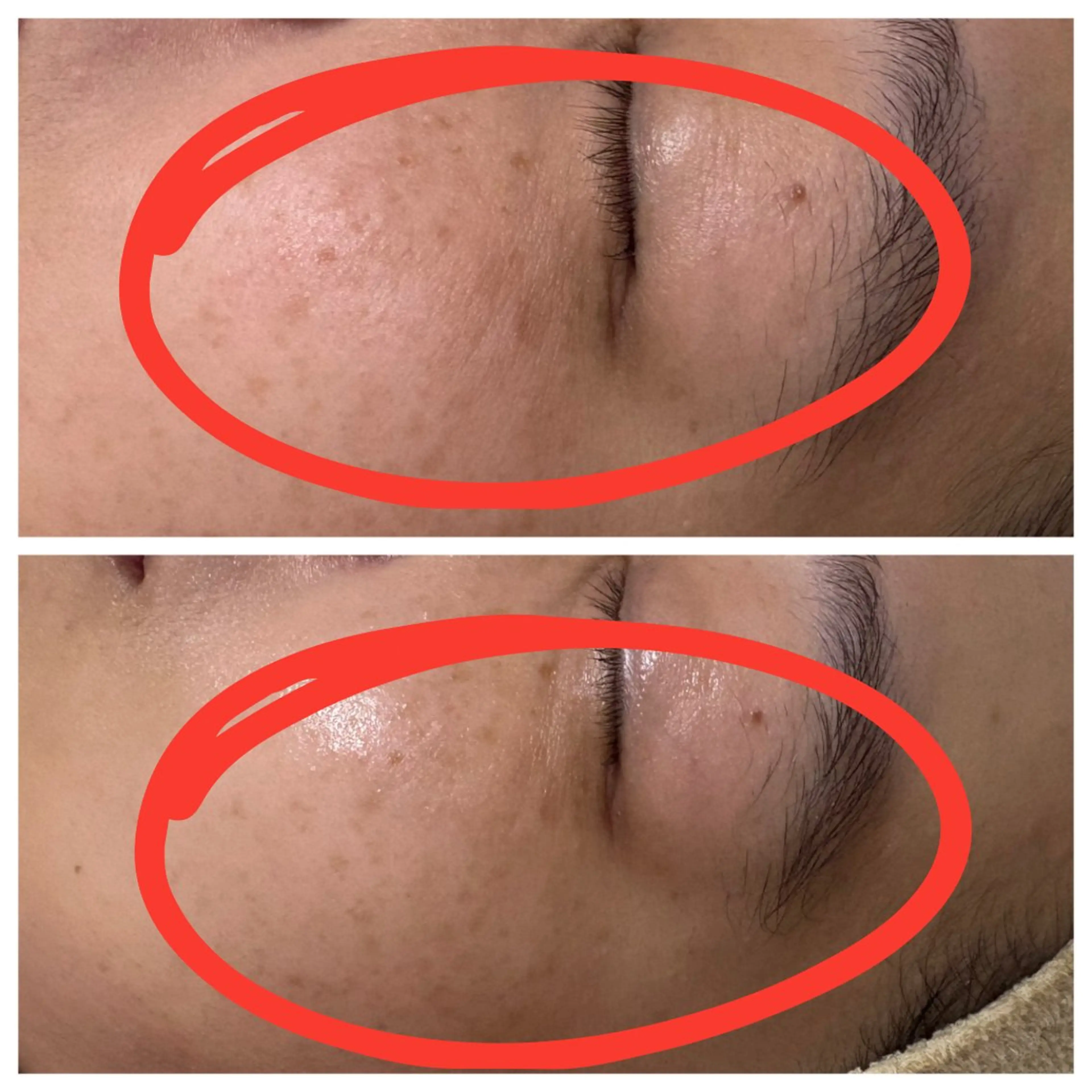 Lilas所属・迫原 麻衣のエステ・リラクイメージ