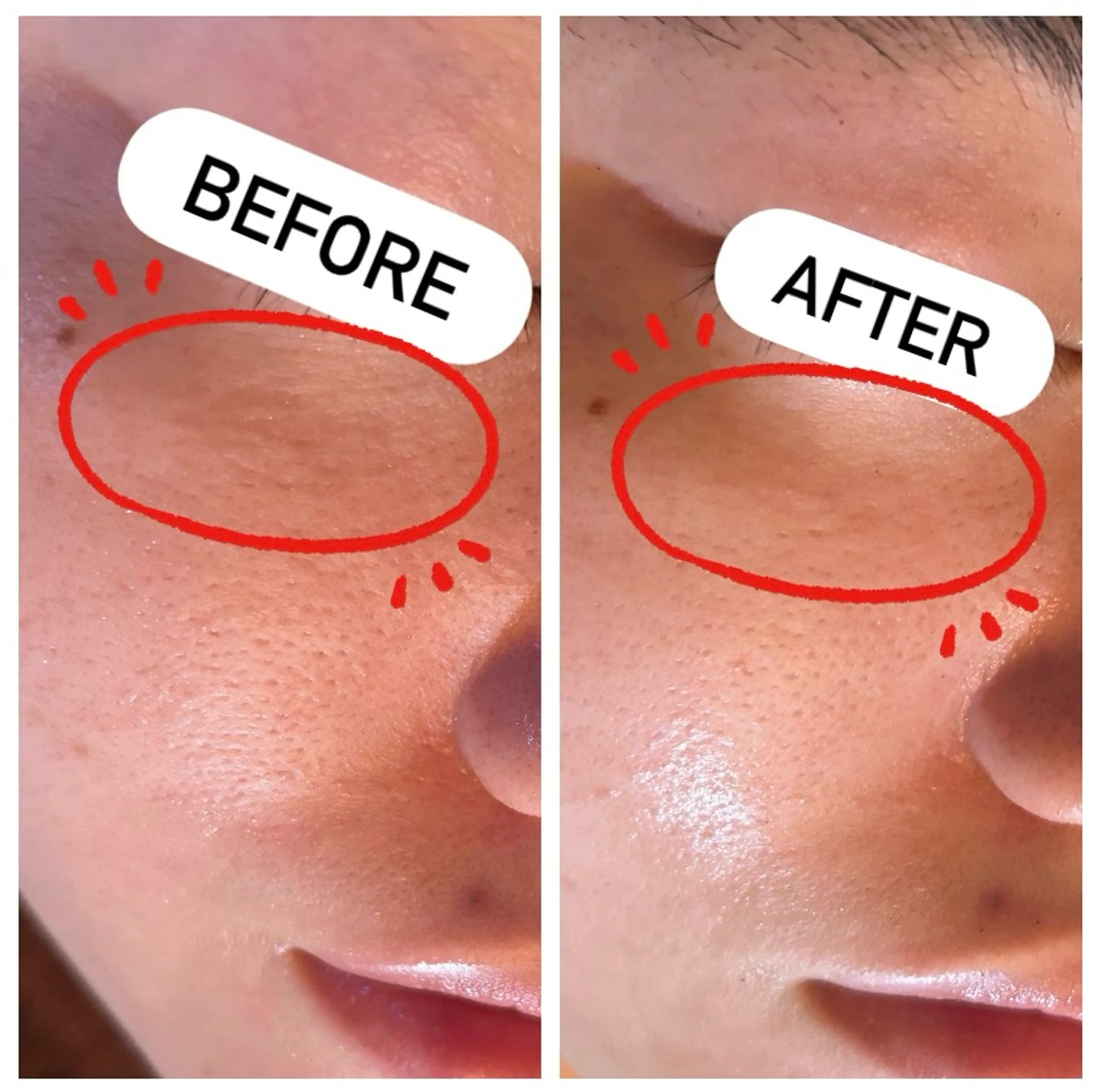 エステ 肌質改善専門 ハーブ /毛穴洗浄 リエイトのエステ・リラクイメージ