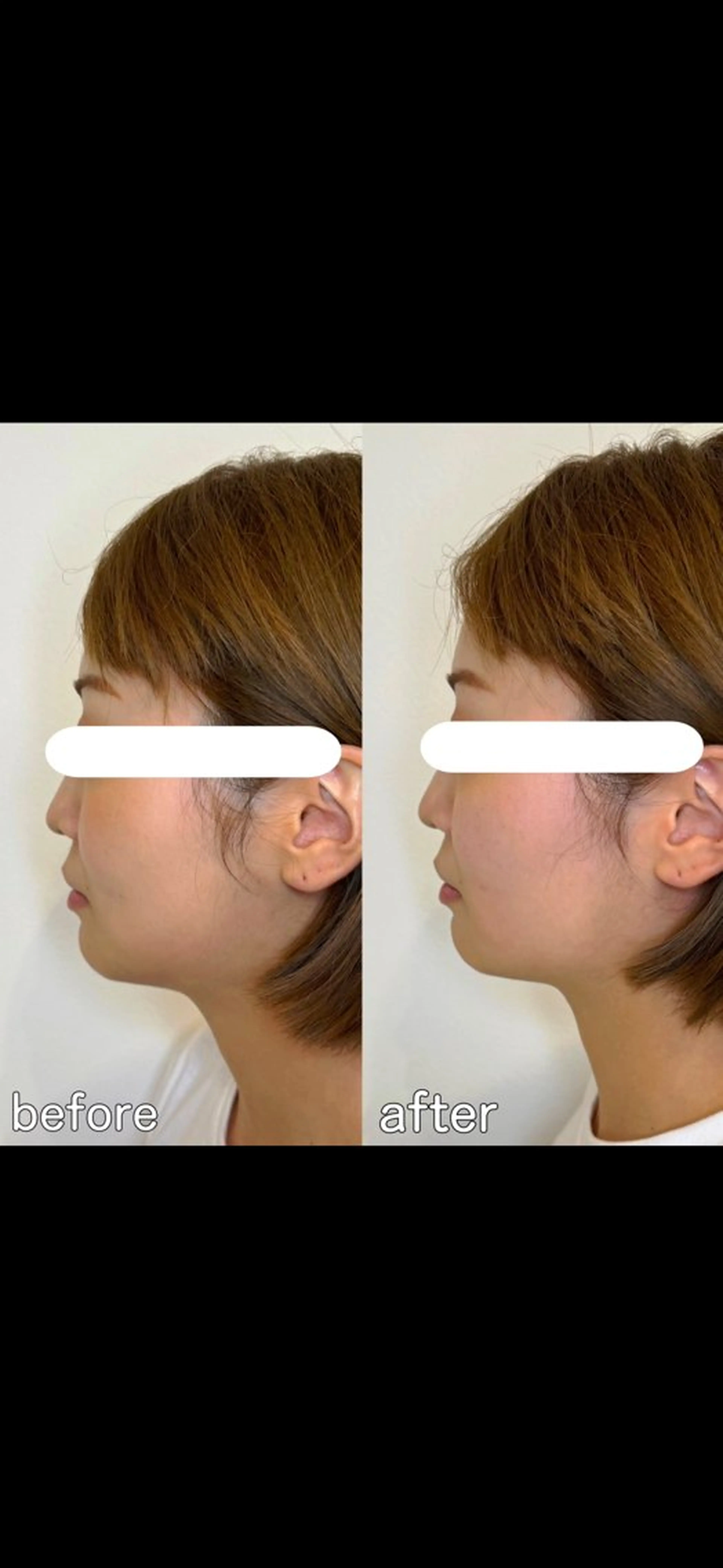 小顔矯正&美容整体 整え屋REDオーナーのエステ・リラクイメージ