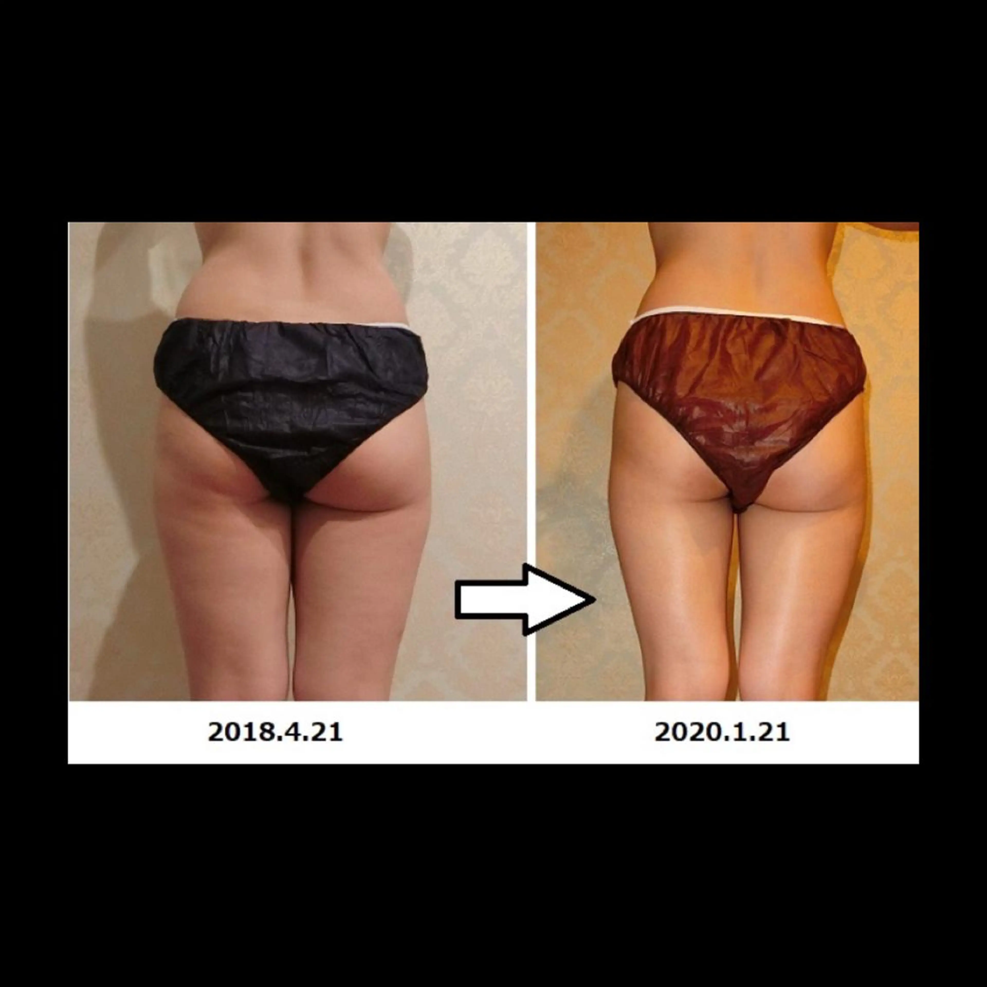 くびれ作り専門サロン こねこのシッポ虎ノ門のエステ・リラクイメージ