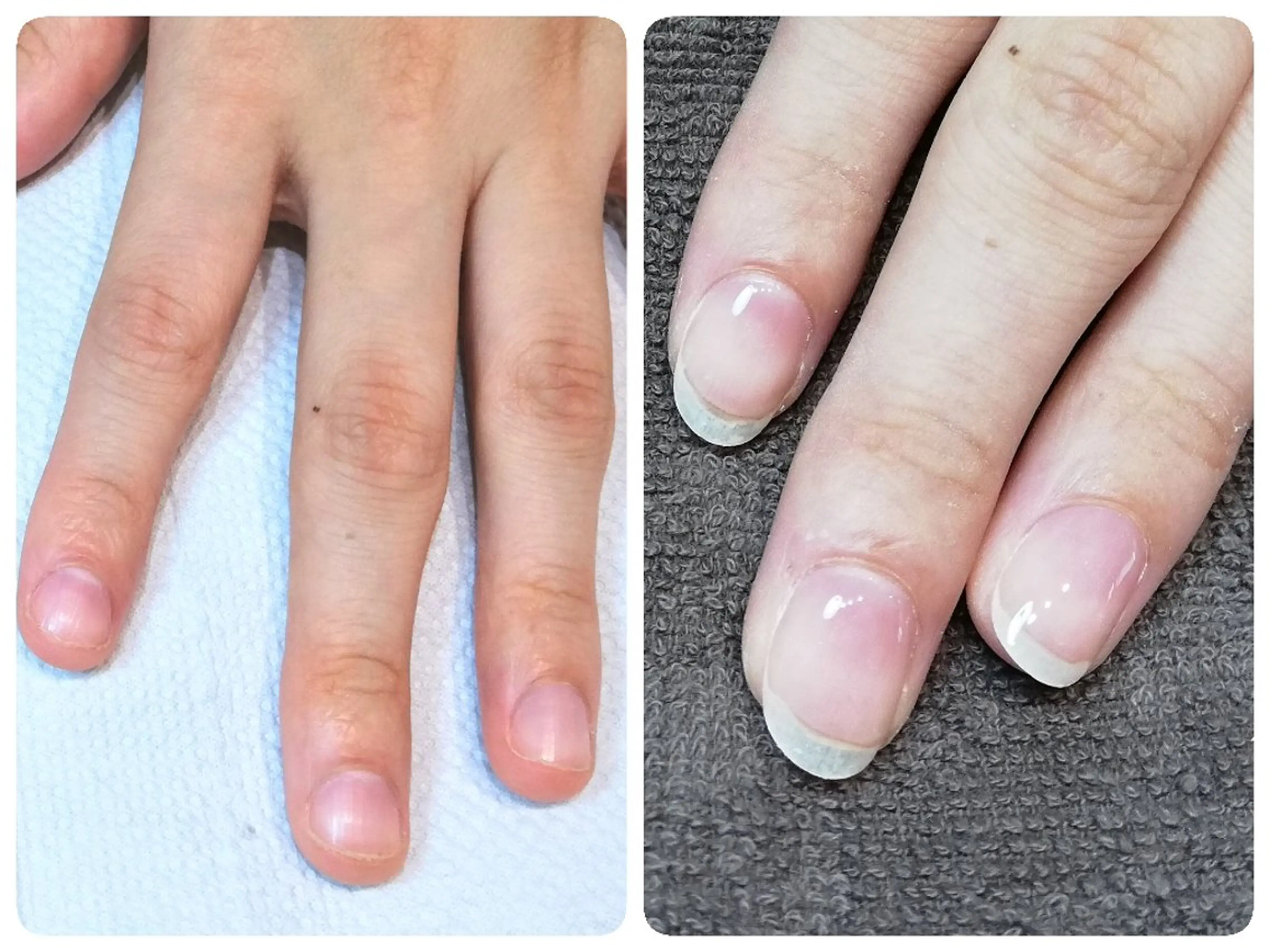 ネイル 長さ出し ハンドネイル ハンドケア 深爪矯正/爪育成ケア manie nailのネイルデザイン