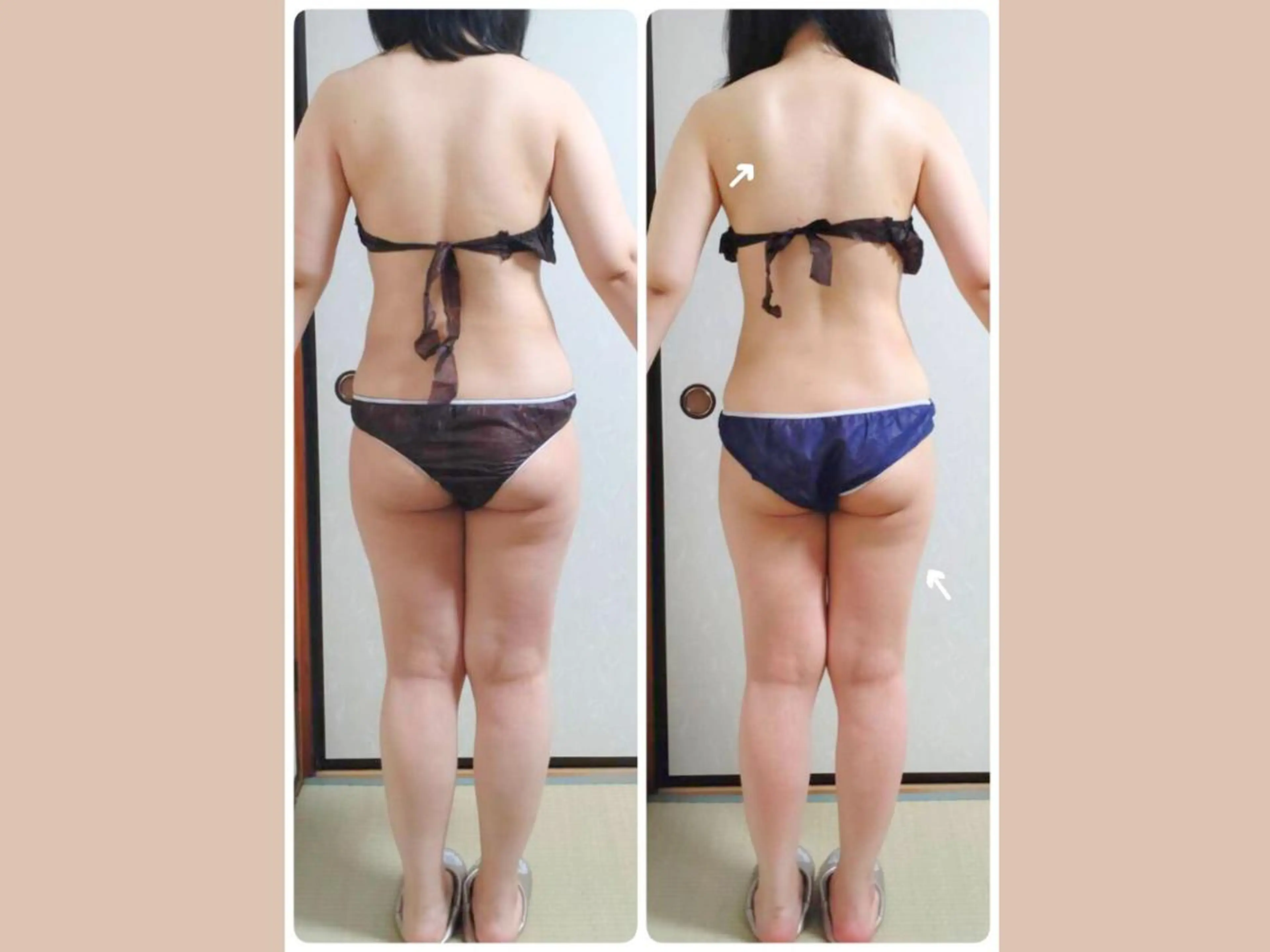 その他 痩身&小顔矯正専門店 Re:Livesのエステ・リラクイメージ