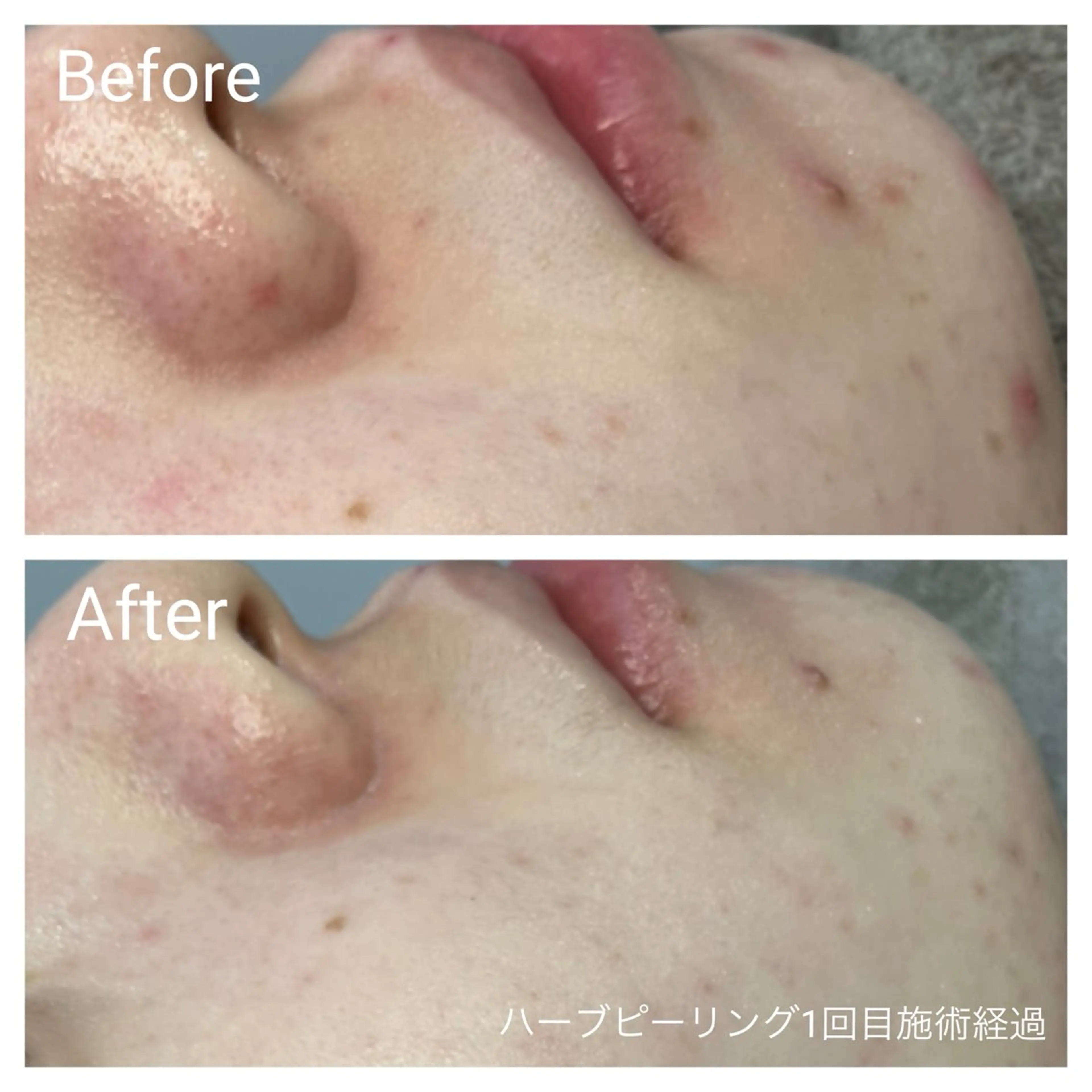 エステ リラク 深い肌悩み専門 フェイシャルサロンのエステ・リラクイメージ