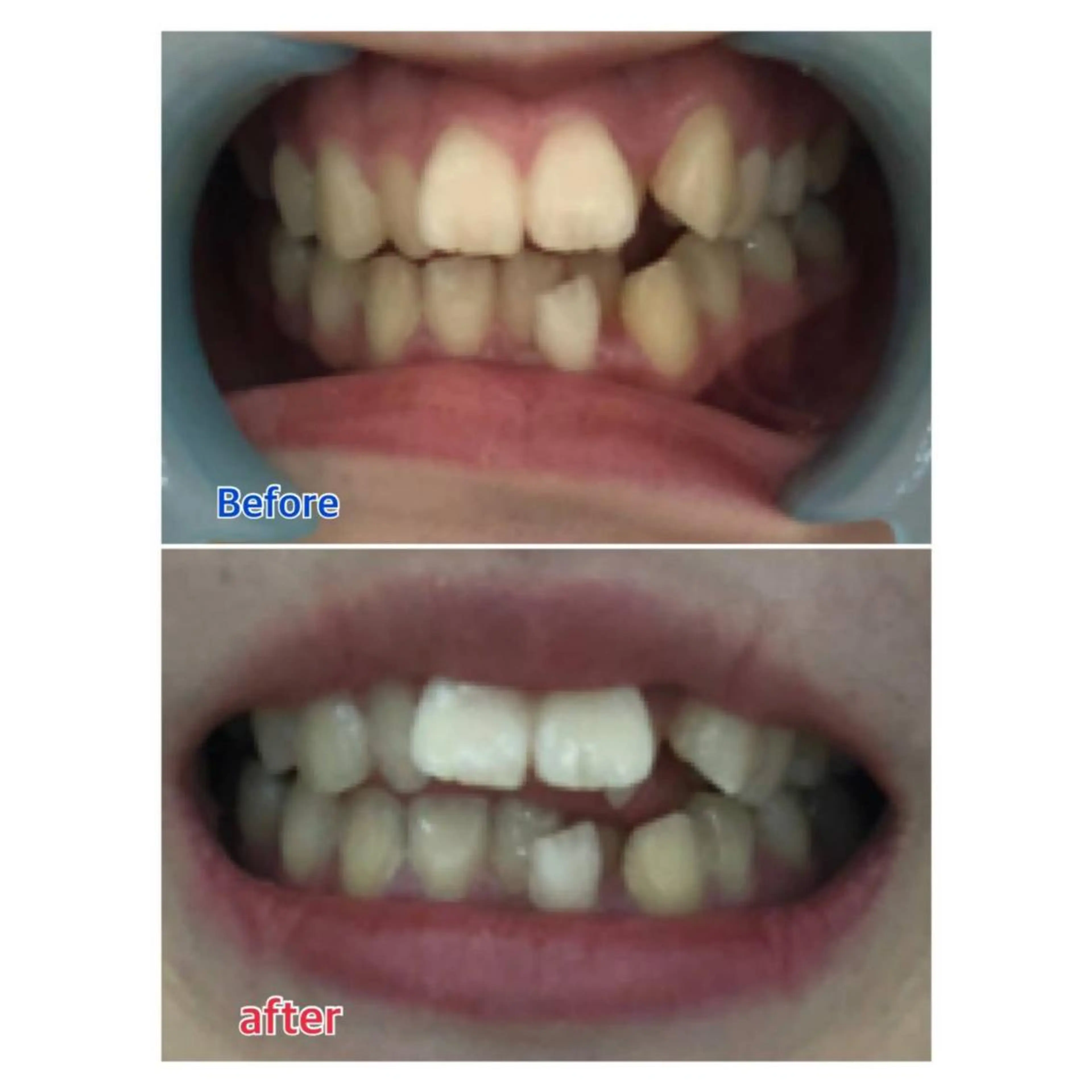 MBEAUTYSALON 千葉店・京成大久保所属・Melty 輝のその他イメージ