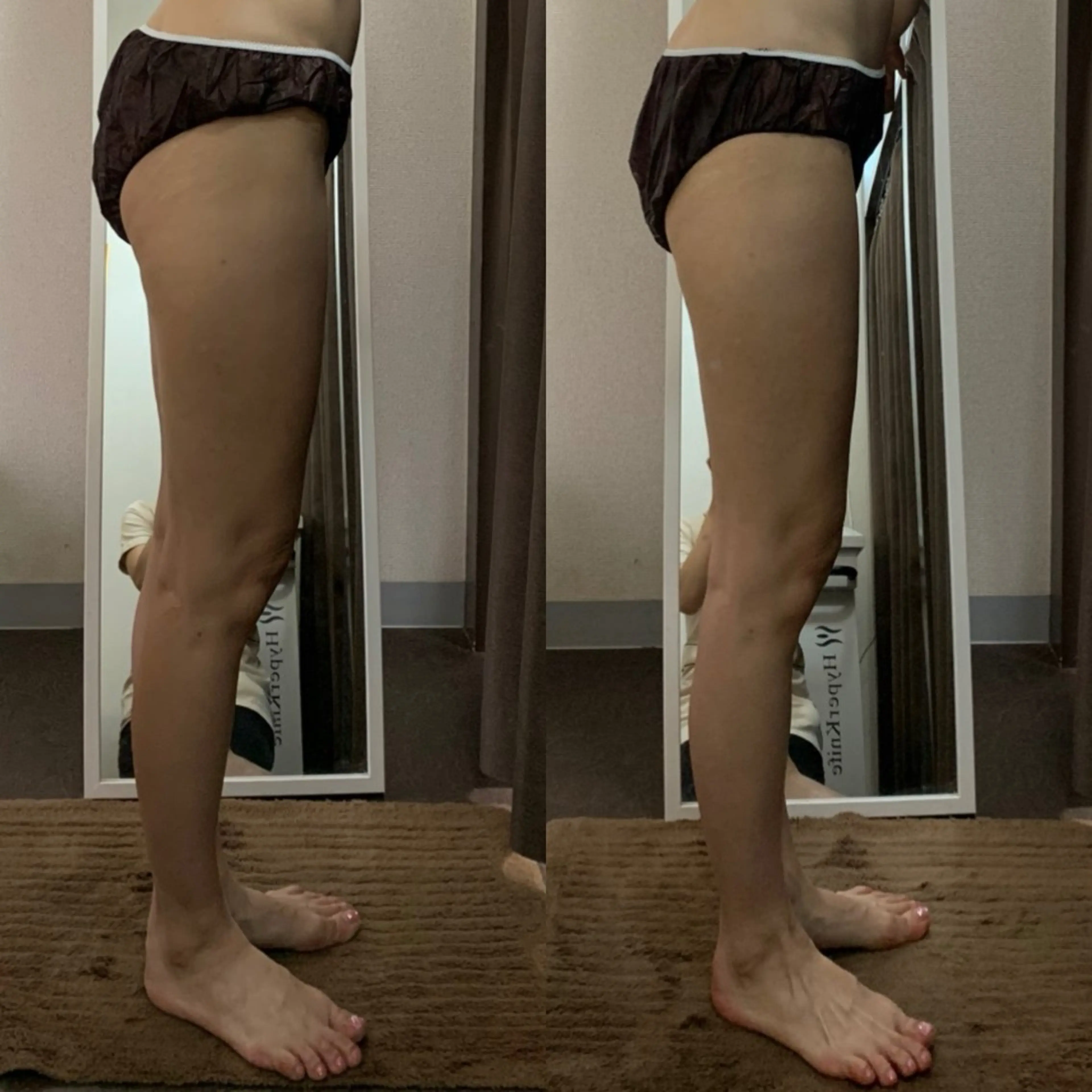 ハイパーナイフ専門店　Salon de COCO所属・Salon de COCOのエステ・リラクイメージ