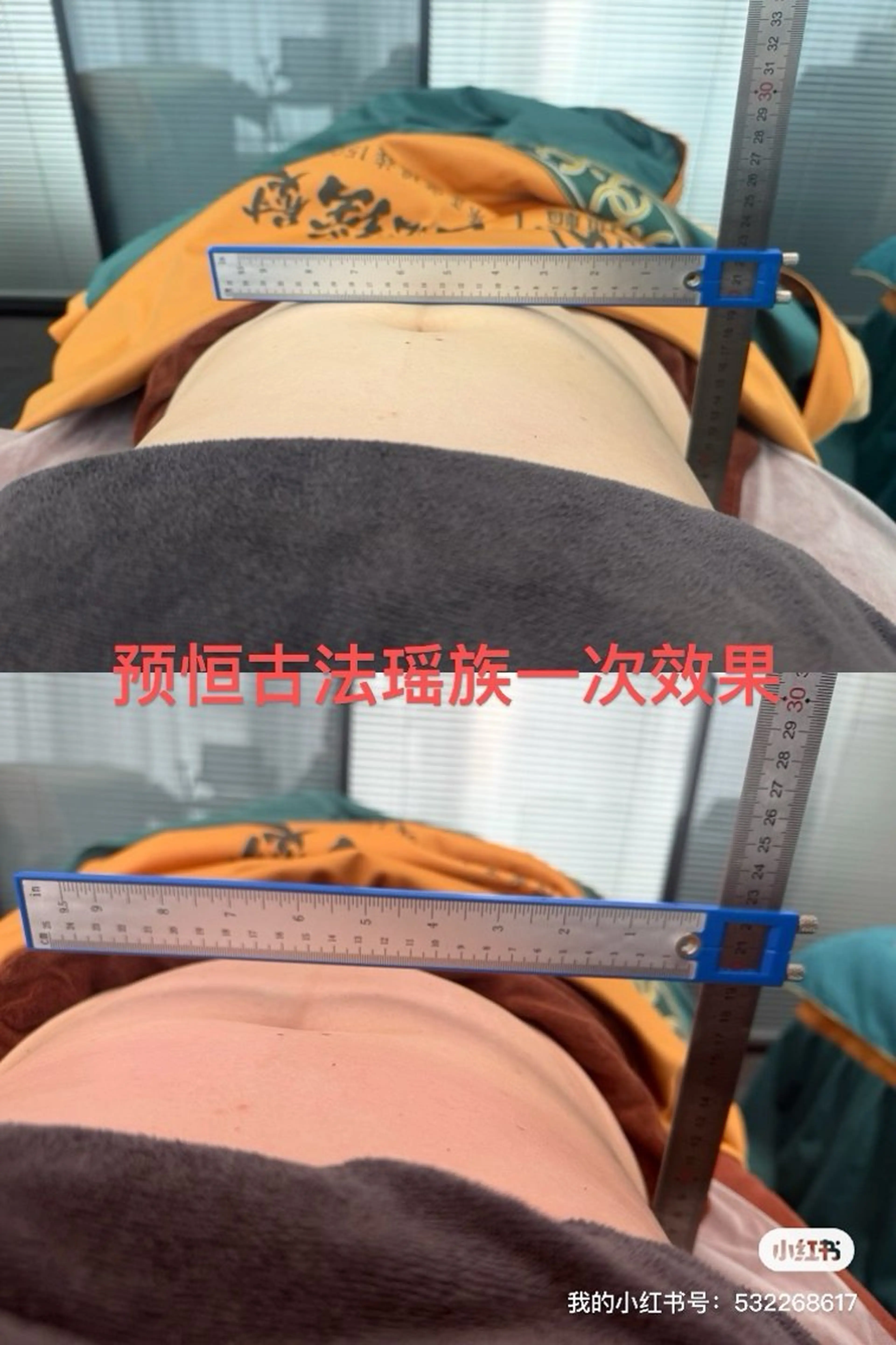 腹部 蜂毒オイル調整 50分 ＋ 漢方瑶熨 20分の写真