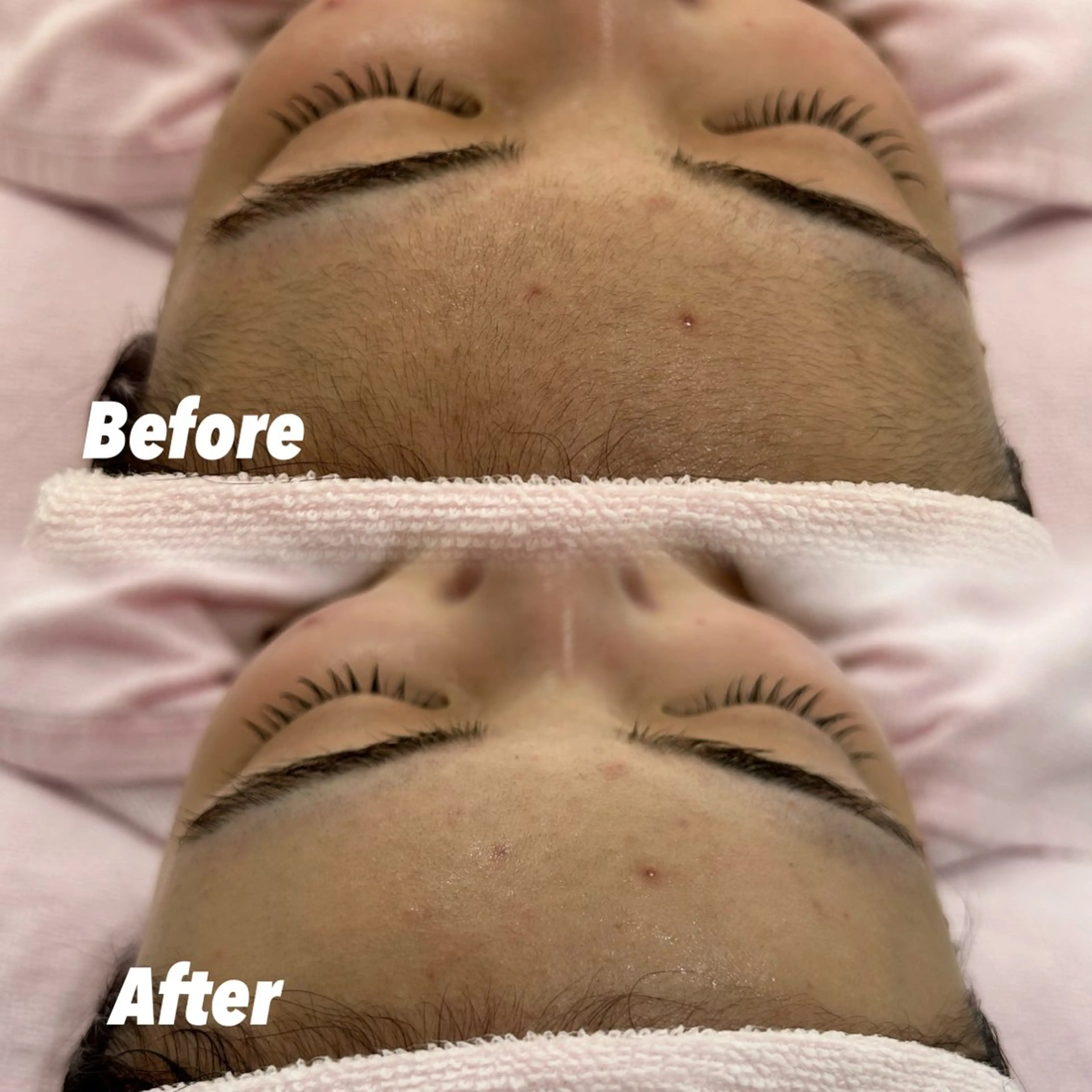 🫧美しい素肌へ🫧 今成柚乃のその他イメージ