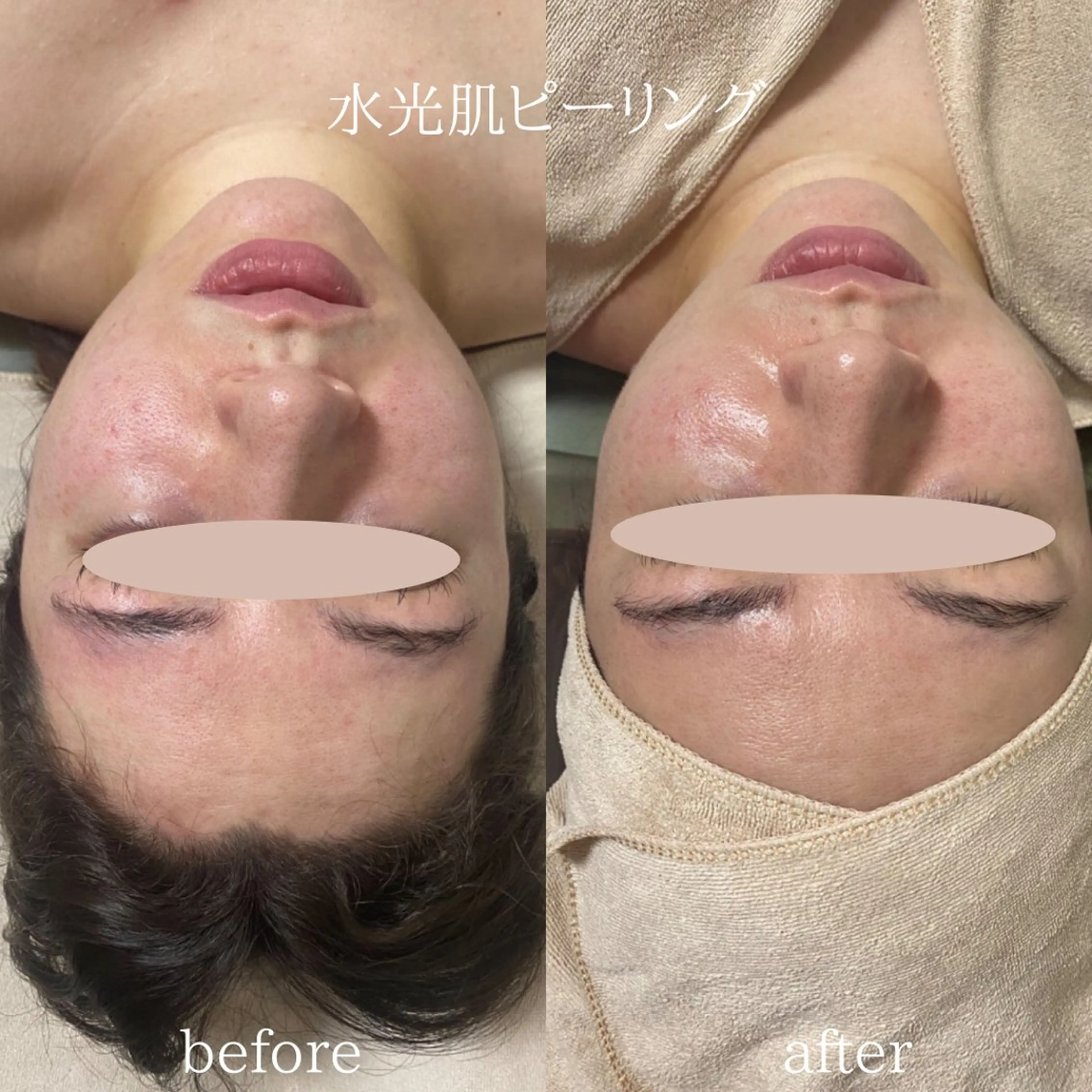 美腸サロン🌺 腸もみ/小顔/リンパのエステ・リラクイメージ