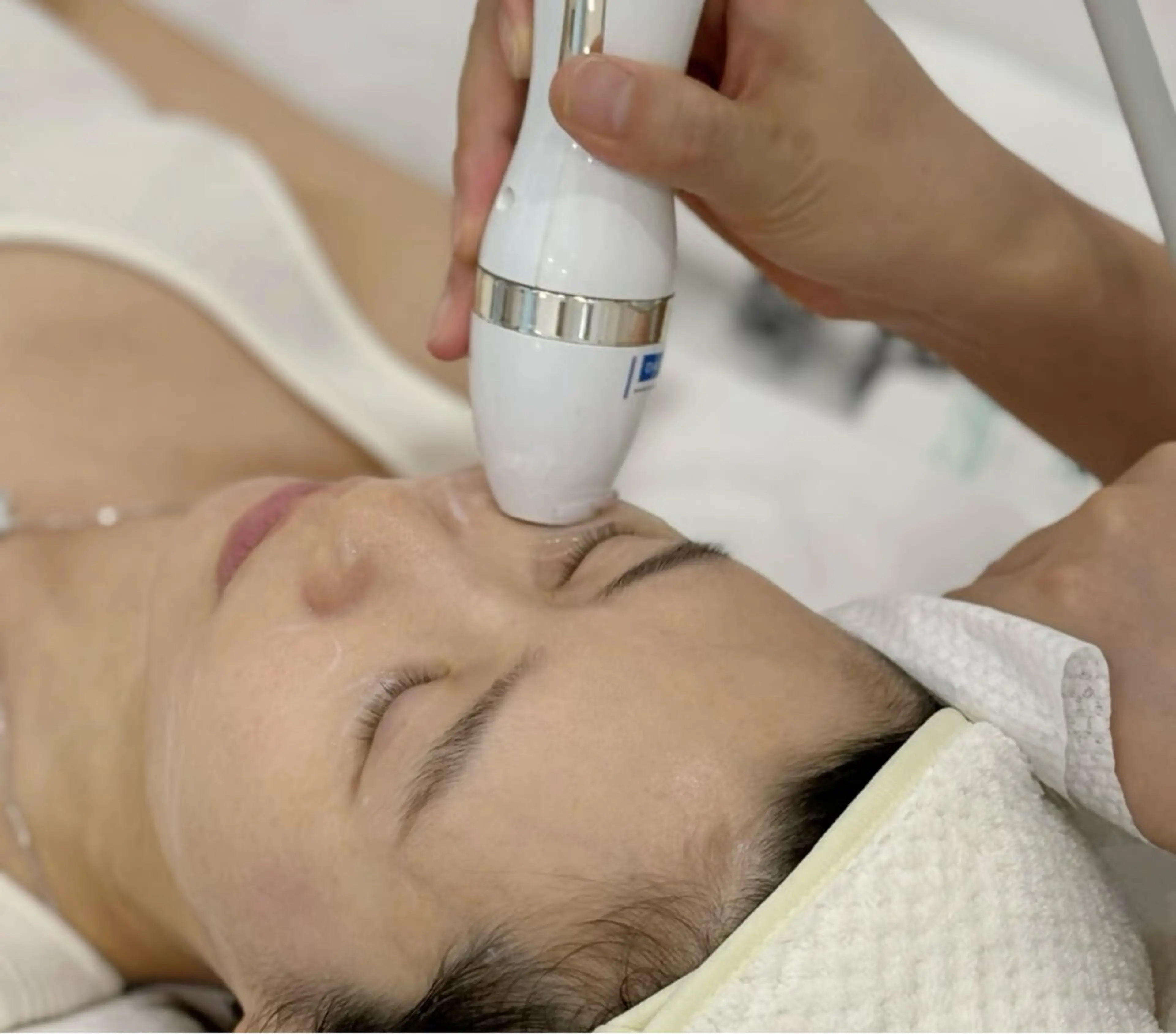 【小顔矯正】顔全体　別人級・切らないリフトアップ！短期間で憧れのVライン形成の写真