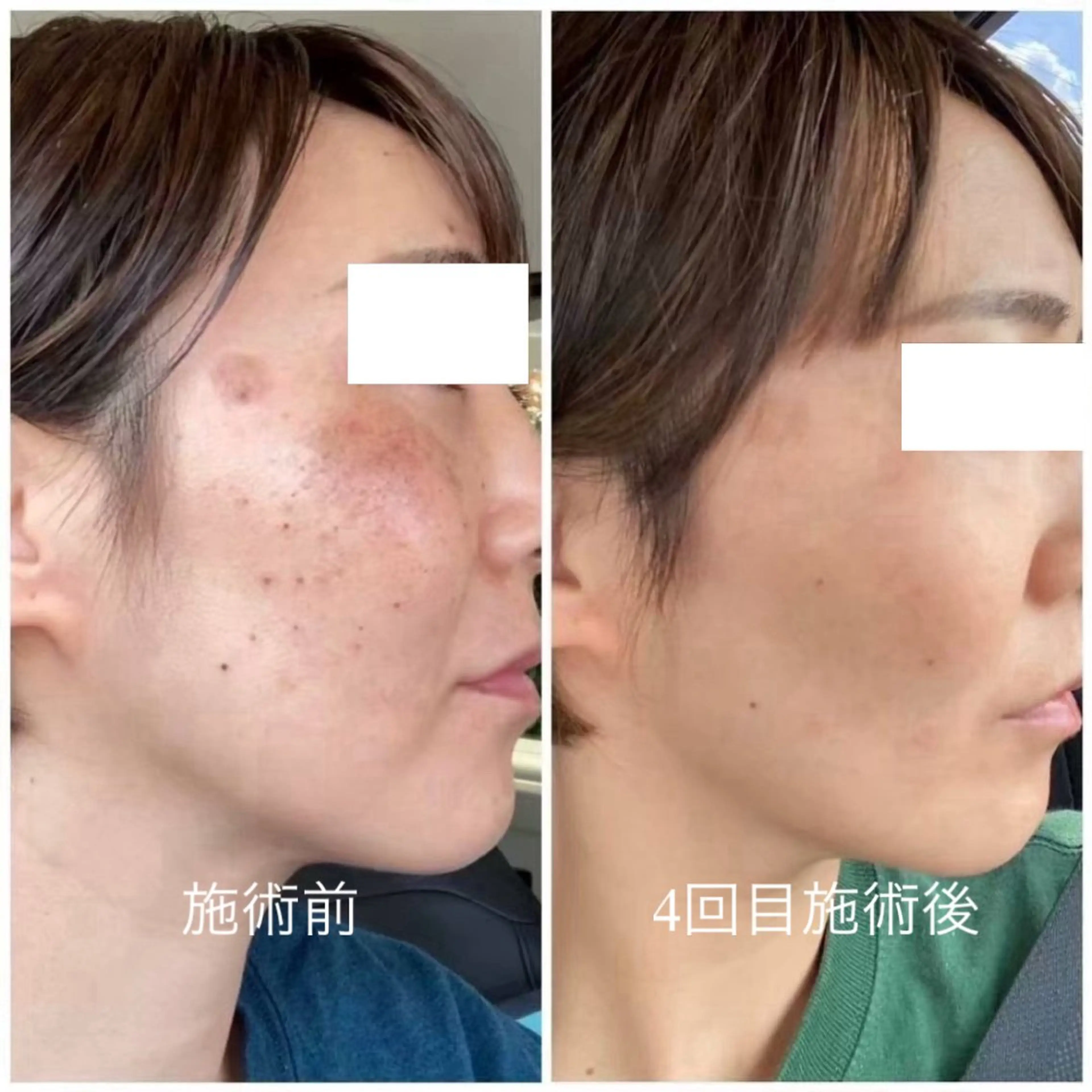 エステ スリーエスプラス内　美肌サロンEme所属・希映 -kieのエステ・リラクイメージ