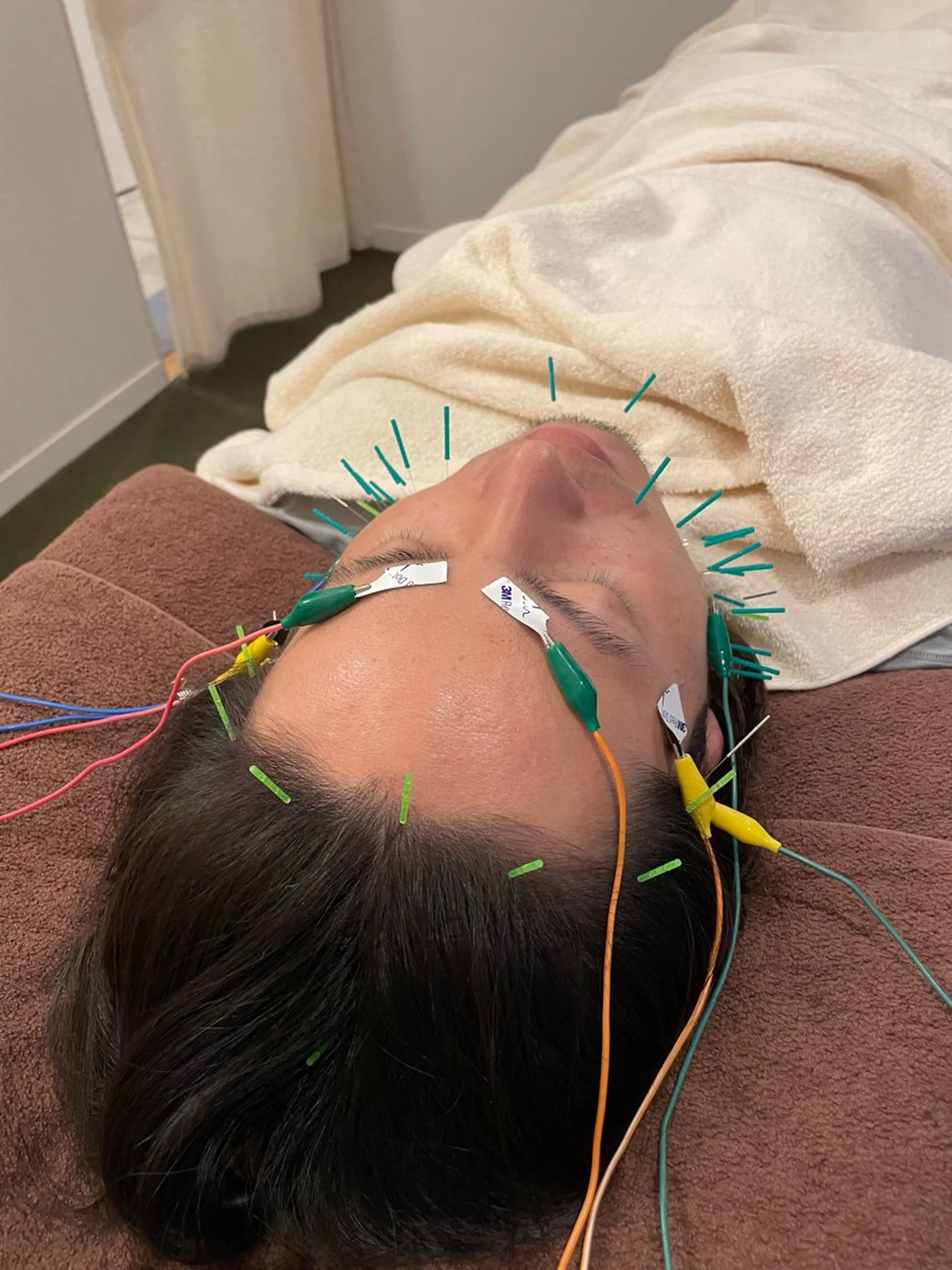 美容鍼　蒼月-aotsuki-所属・美容鍼「蒼月」 -アオツキ-のエステ・リラクイメージ