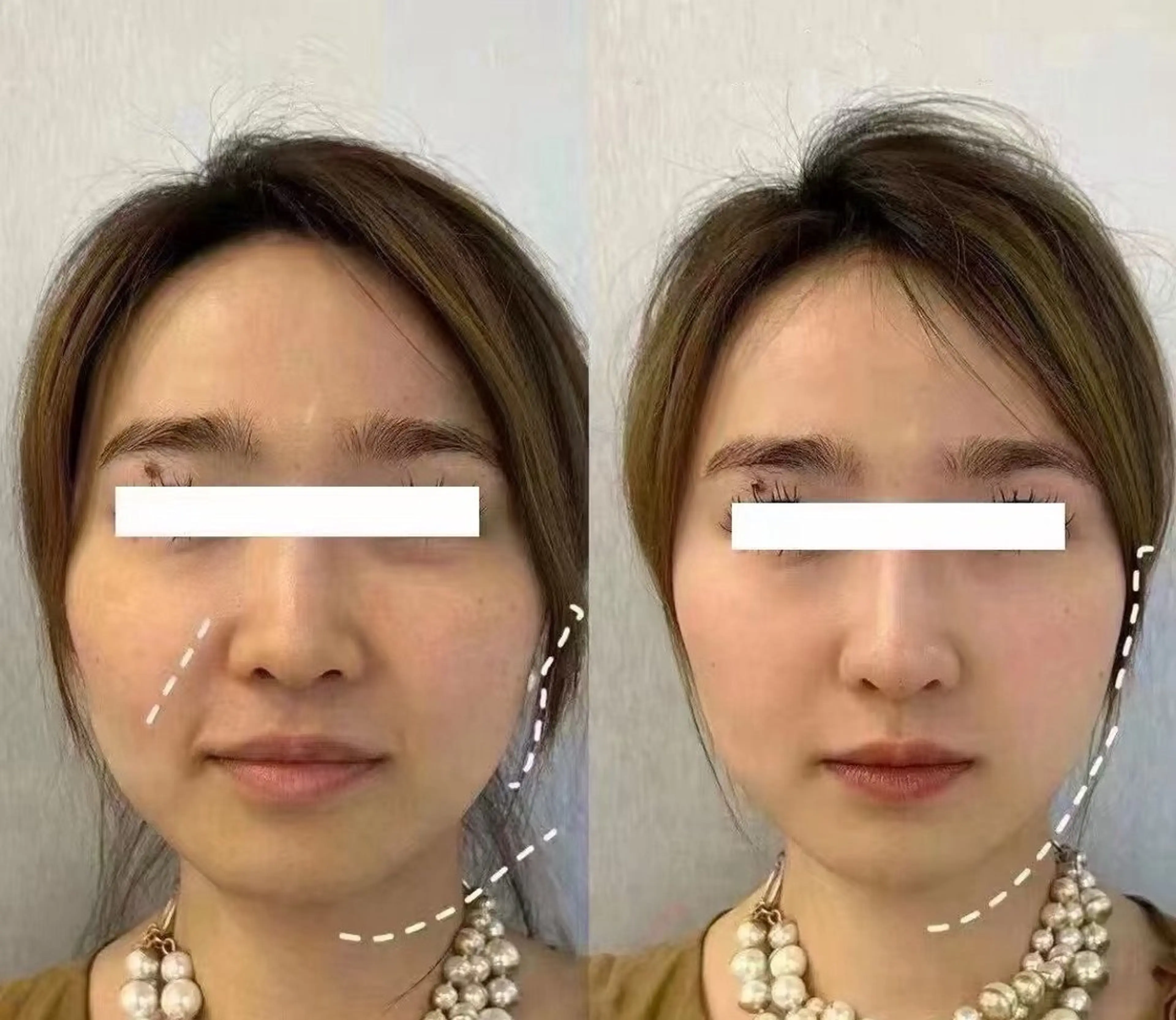 マツエク・マツパ エステ aliaハイフ&水光ジェットサロン所属・aliaハーブ水光店 エステティシャン募集のエステ・リラクイメージ