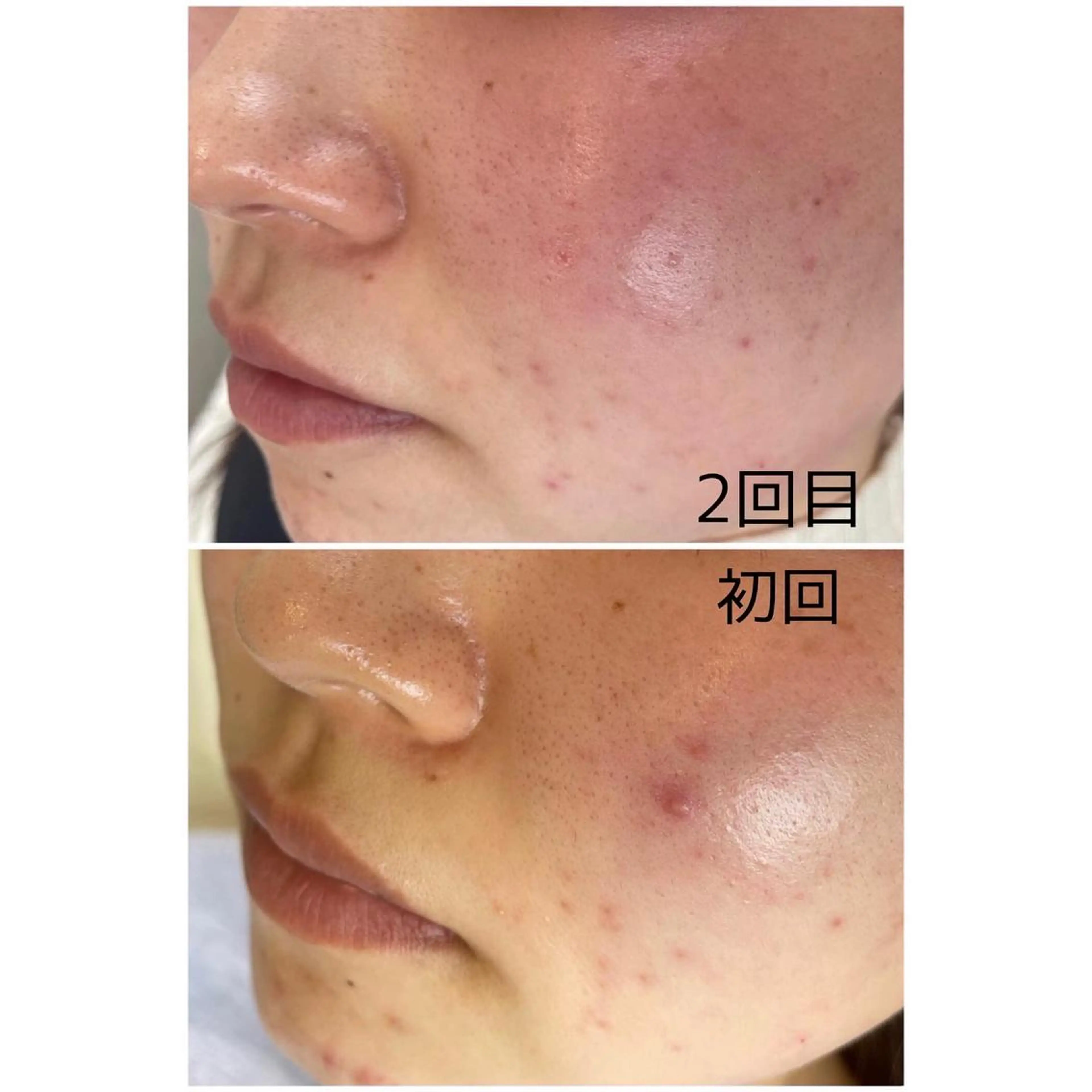 soresfy所属・soresfy makiのマツエク・マツパデザイン