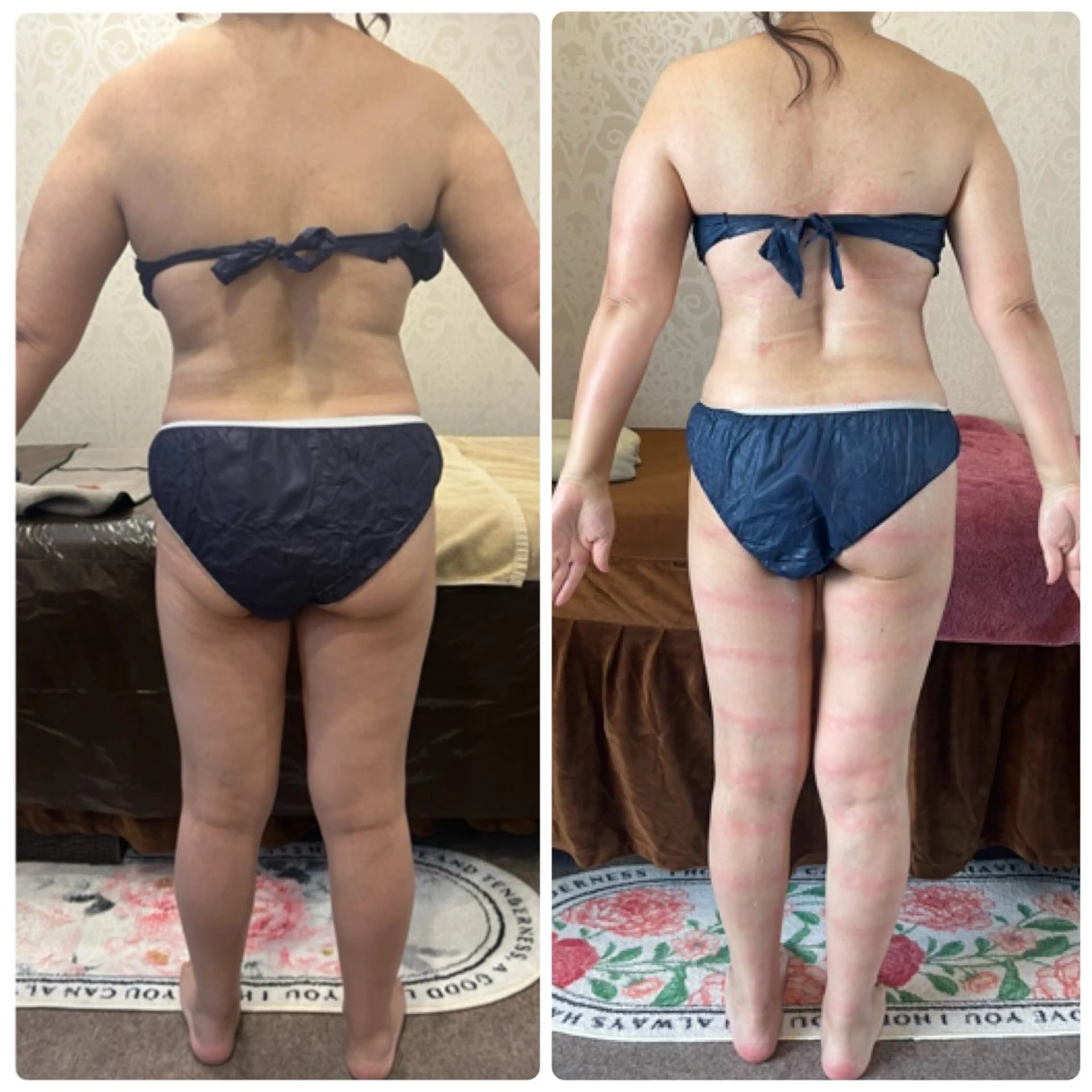 エステ リラク FLEUR大阪・美容 整体・痩身・小顔のエステ・リラクイメージ