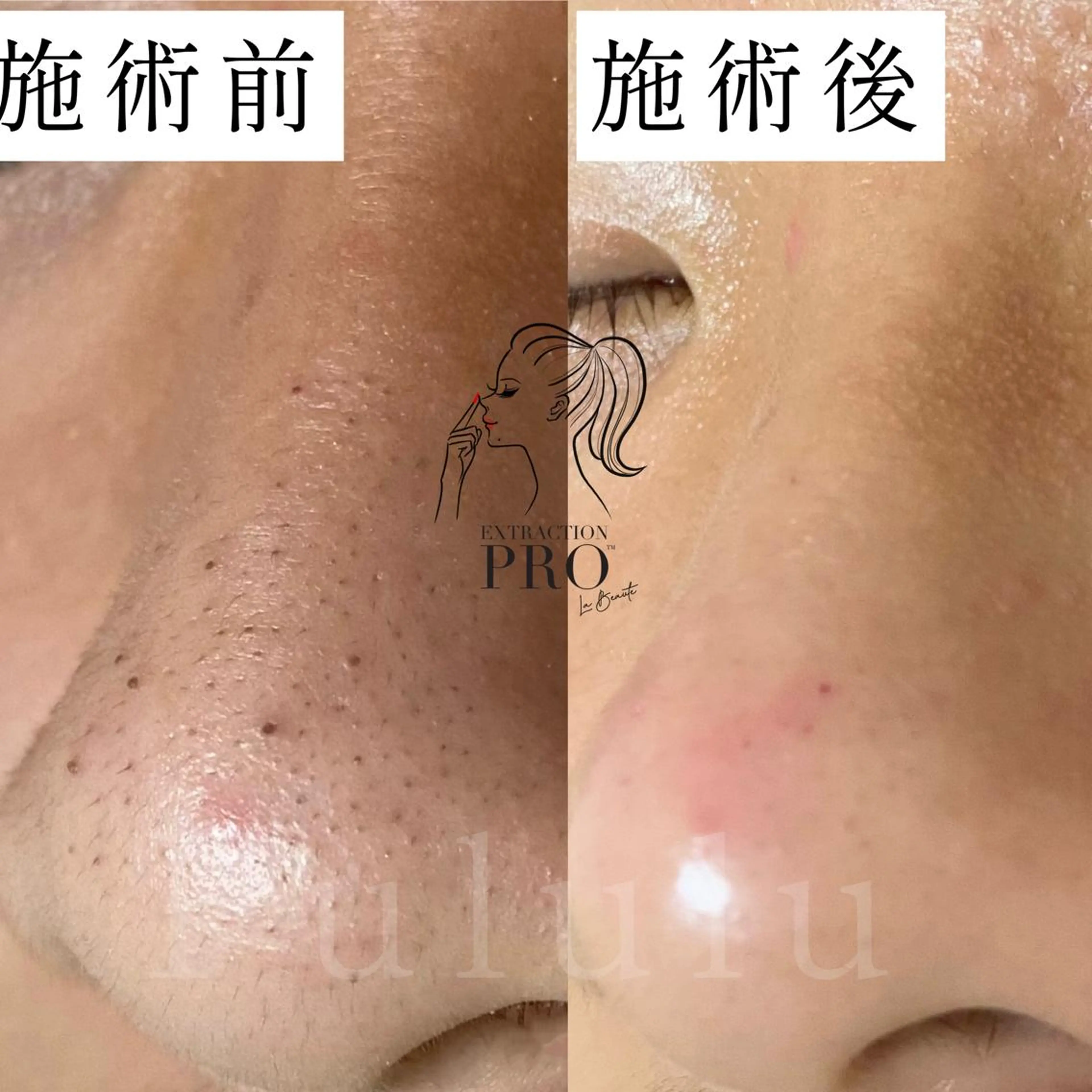 毛穴専門サロン　フルール所属・フルールFululu 自由が丘のエステ・リラクイメージ