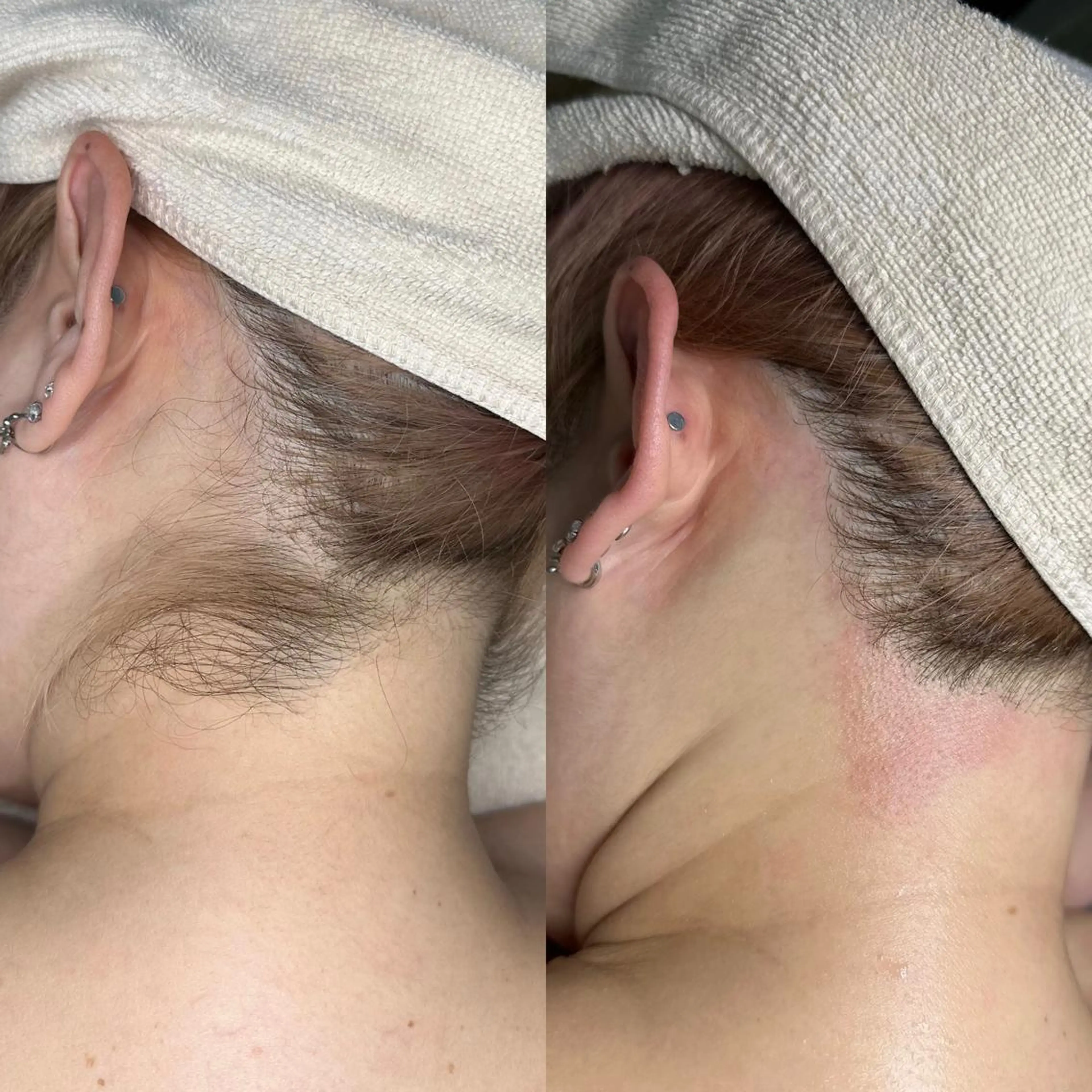 ヘアアレンジ 脱毛 WAX＆光脱毛 ESTHERIAのエステ・リラクイメージ