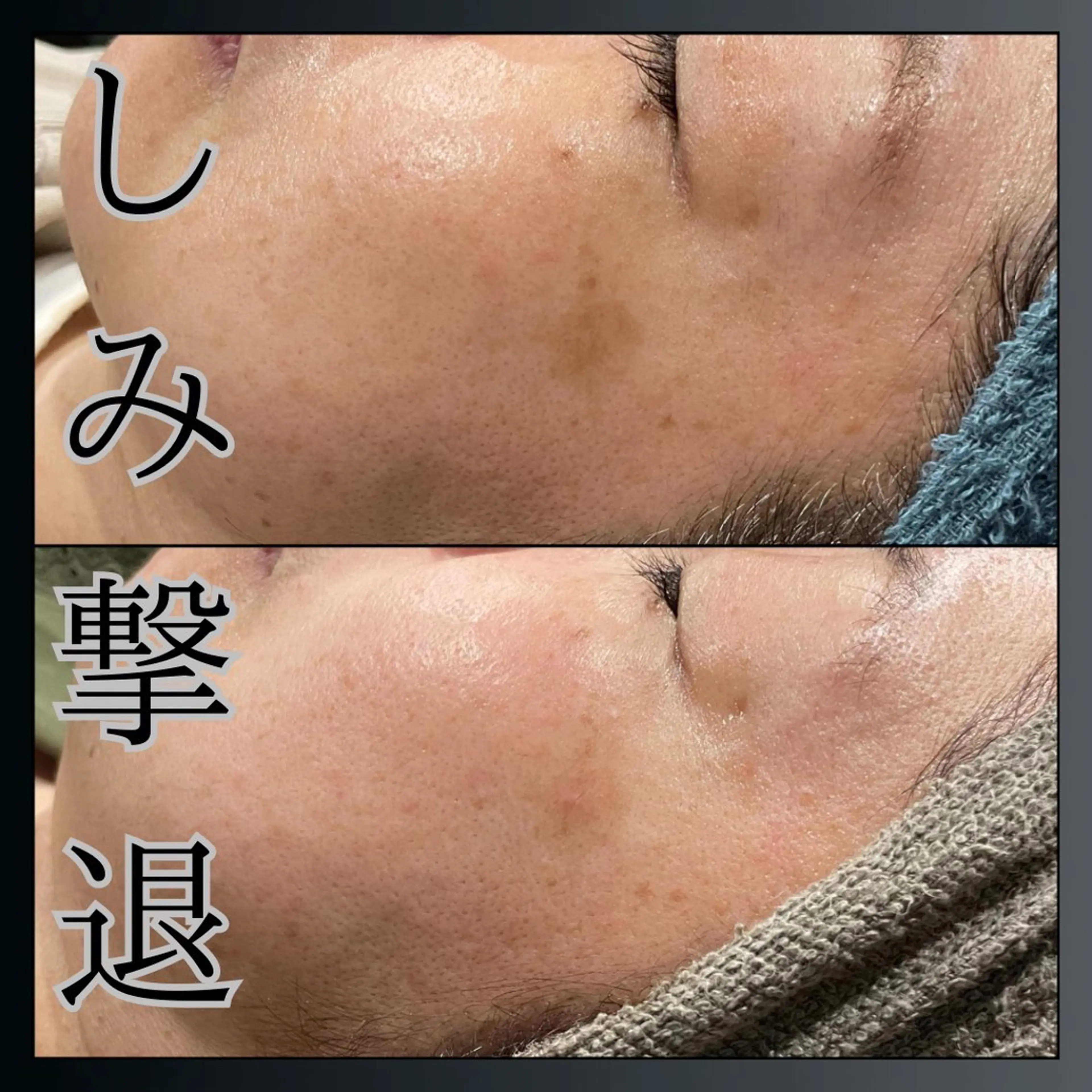 エステ LiZA エステティックサロンのエステ・リラクイメージ