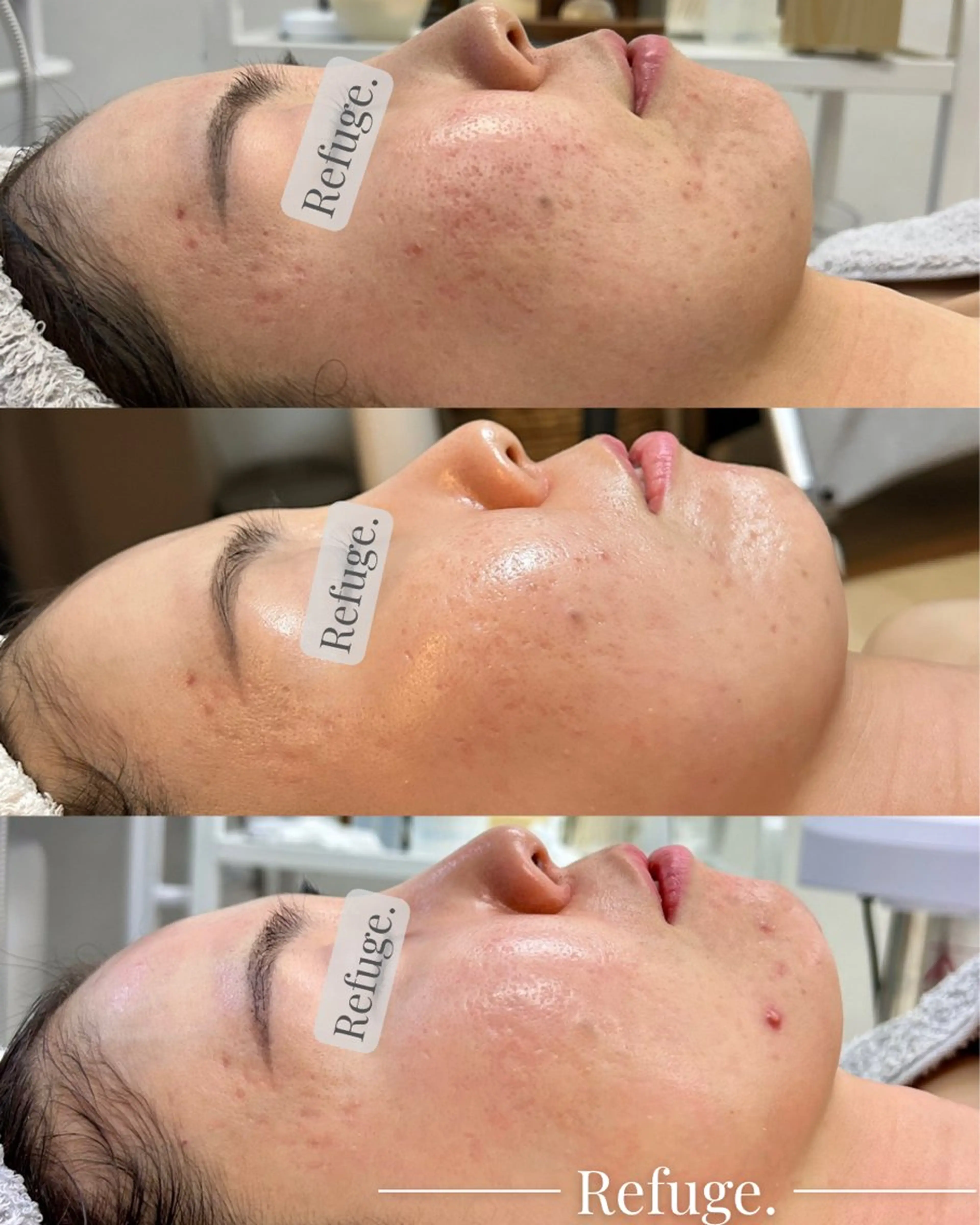 グリーンピール専門サロン Refuge.所属・Refuge. （リフュージュ）のエステ・リラクイメージ