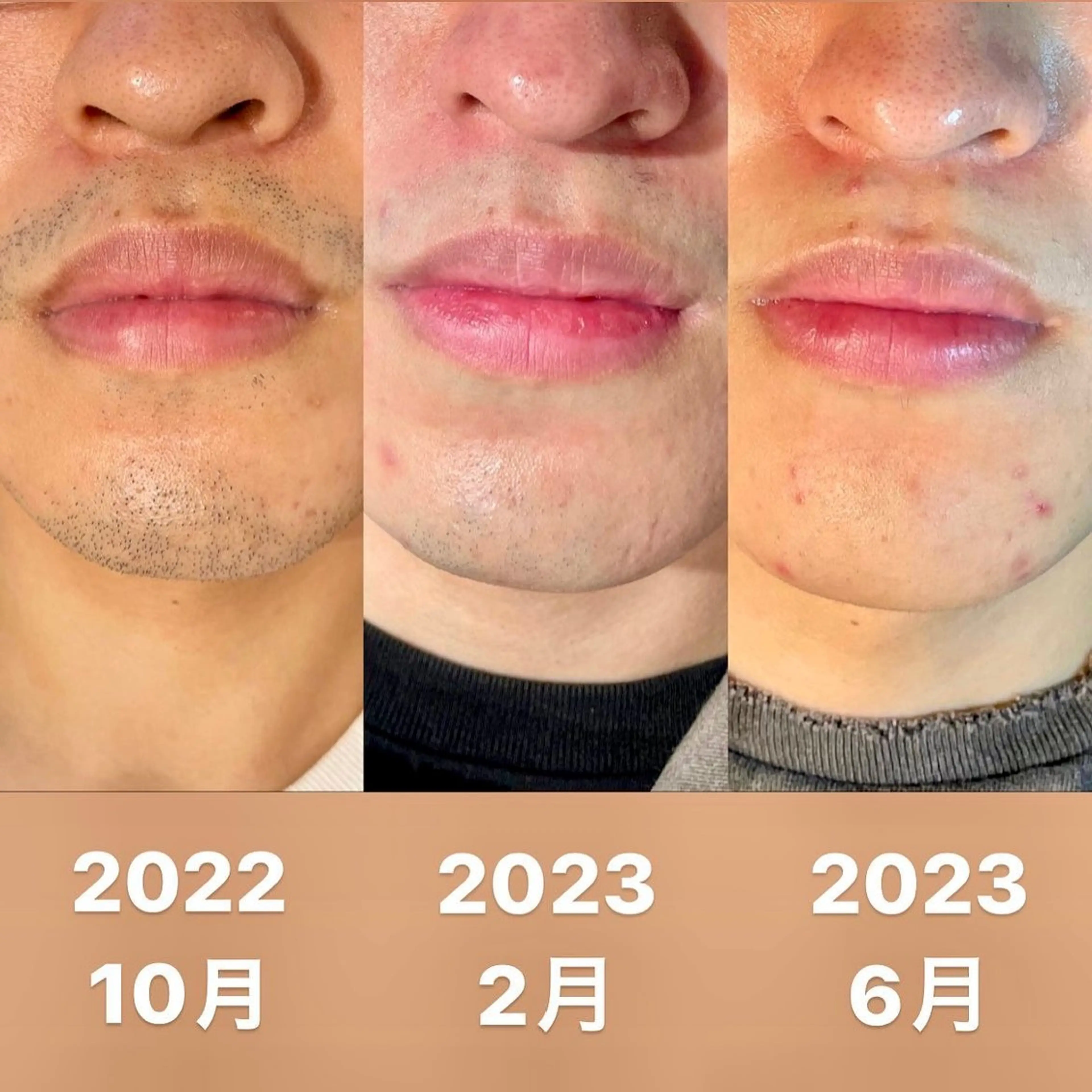 メンズ 脱毛 mew所属・mew メンズ脱毛のエステ・リラクイメージ