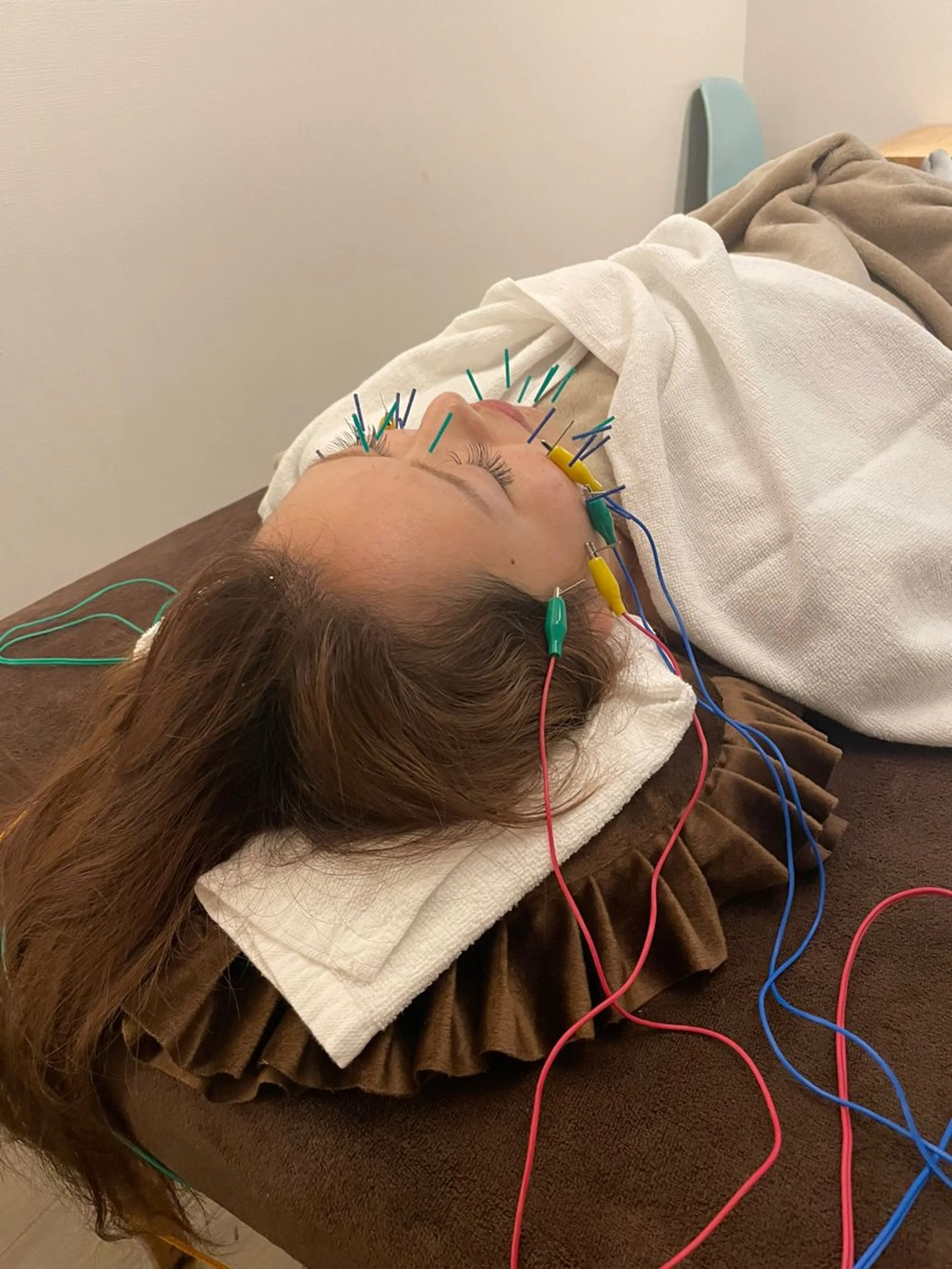 美容鍼/鍼灸 ここみ鍼灸院のエステ・リラクイメージ