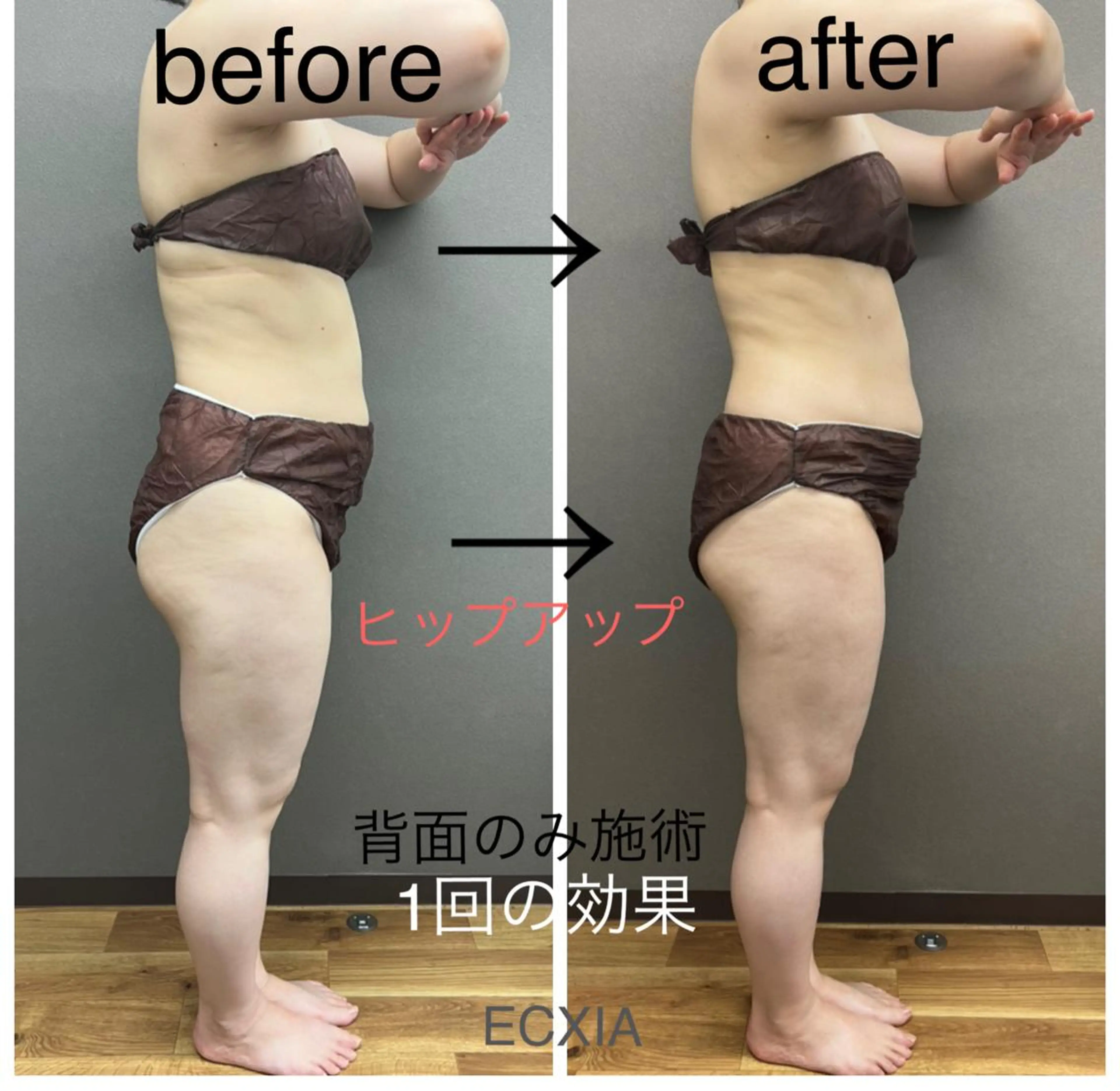 エステ リラク ECXIA 【エクシア】のエステ・リラクイメージ