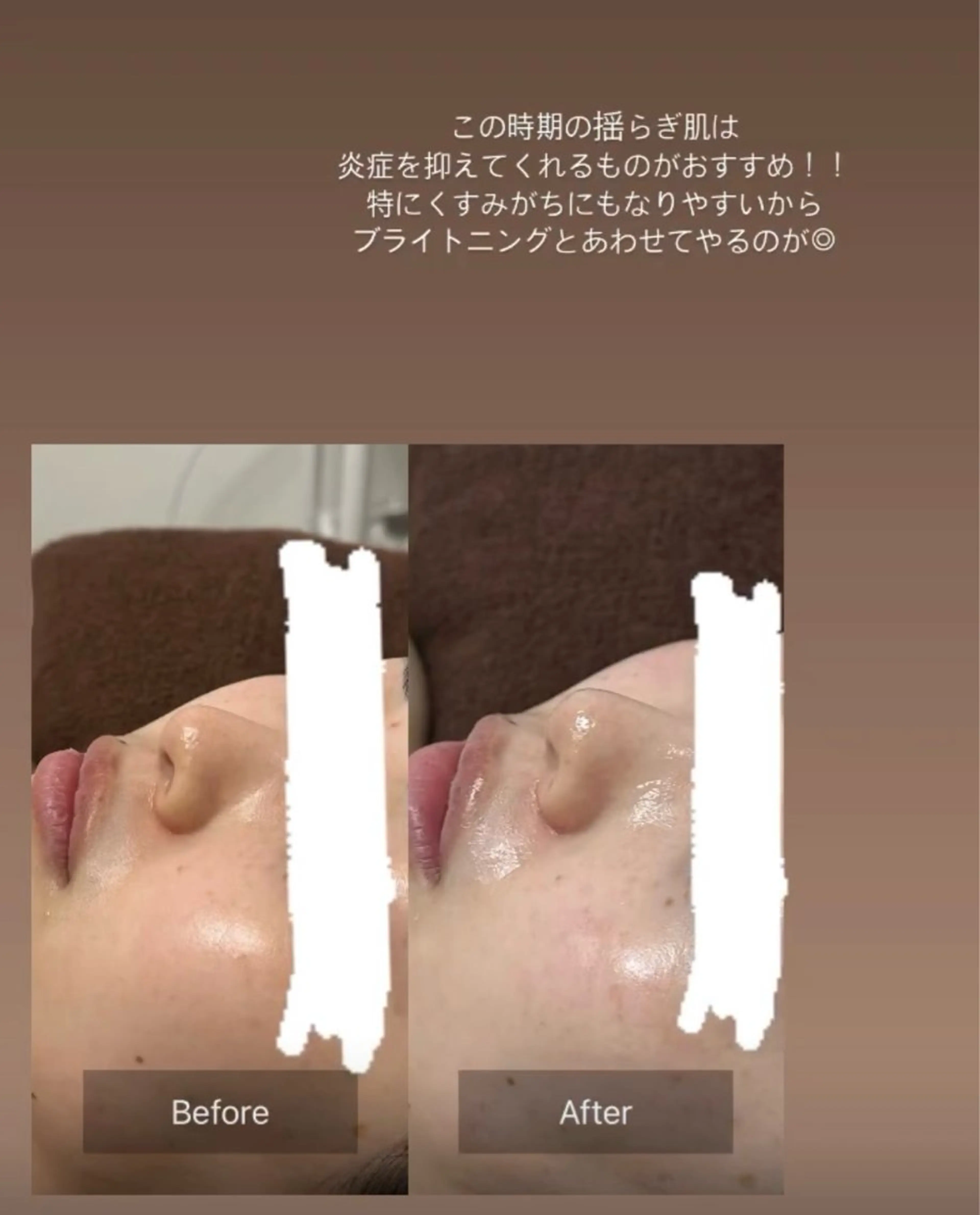 天使の艶肌　REVIハーブピーリング＆ヘッドスパ 武蔵小杉店所属・天使の 艶肌のエステ・リラクイメージ